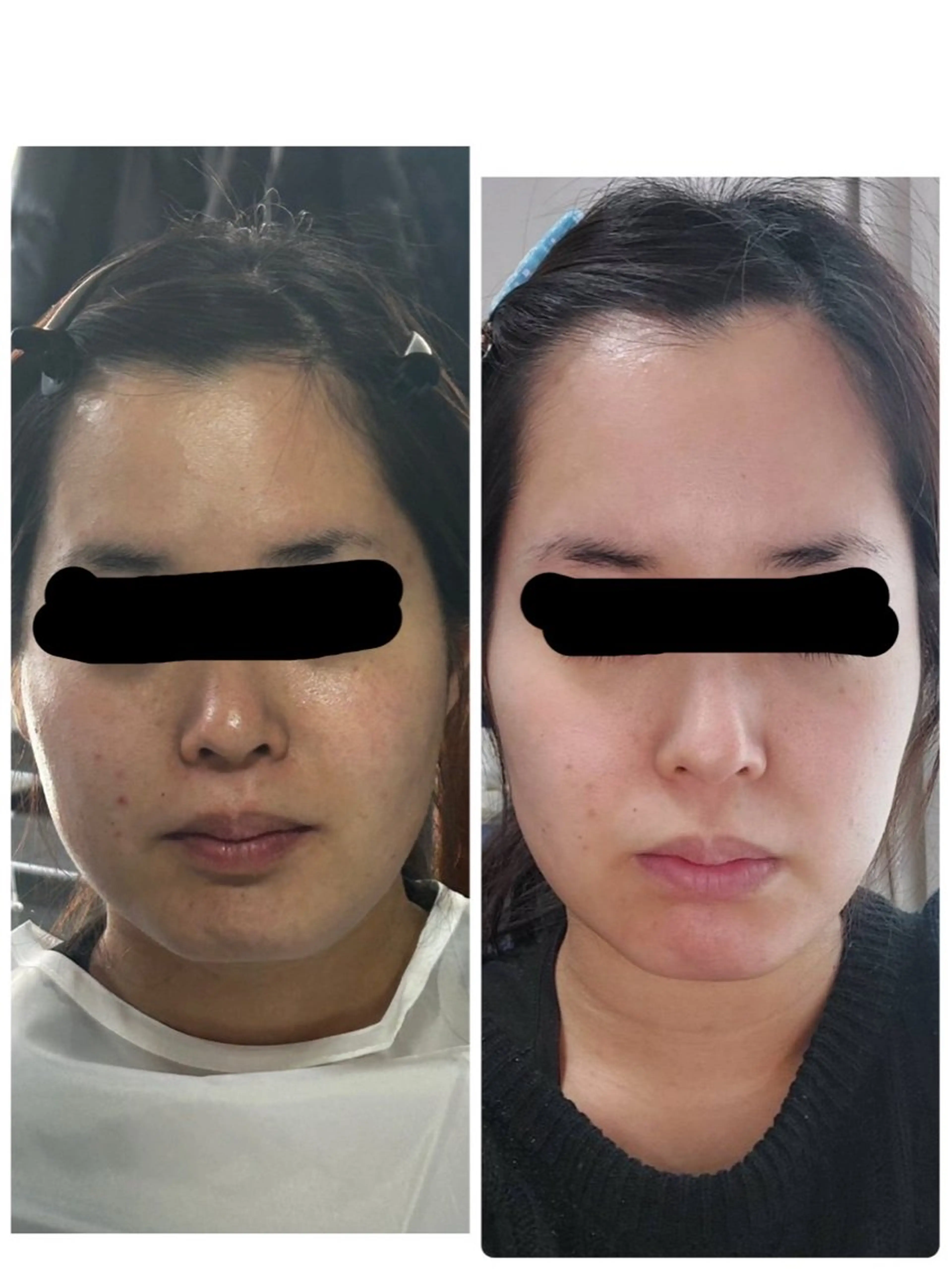 Lulu estheticsalon所属・Lulu 　田村 梨乃のエステ・リラクイメージ