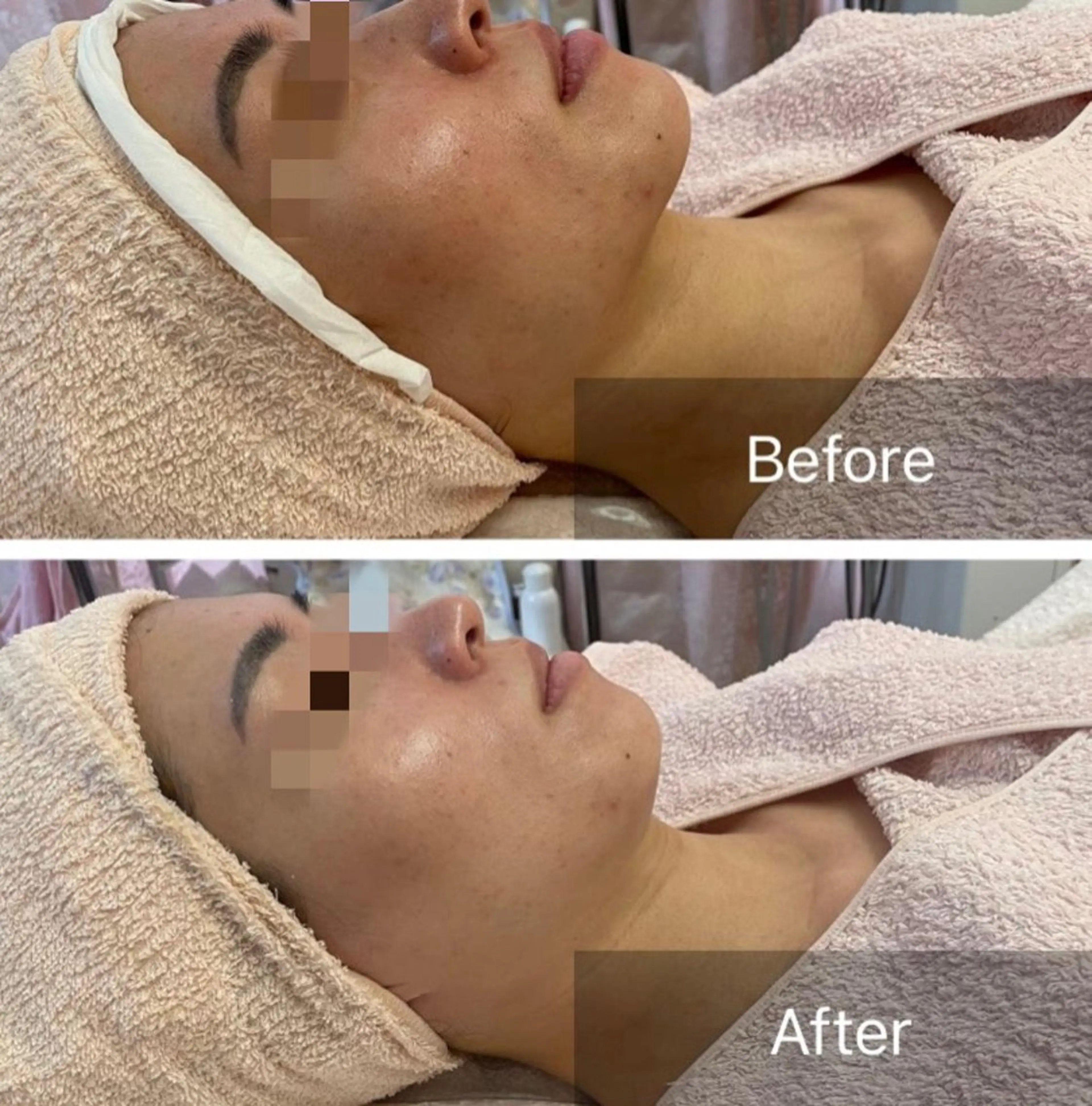 Lis Roseフェイシャルサロン所属・Lis Rose🥀 フェイシャルサロンのエステ・リラクイメージ