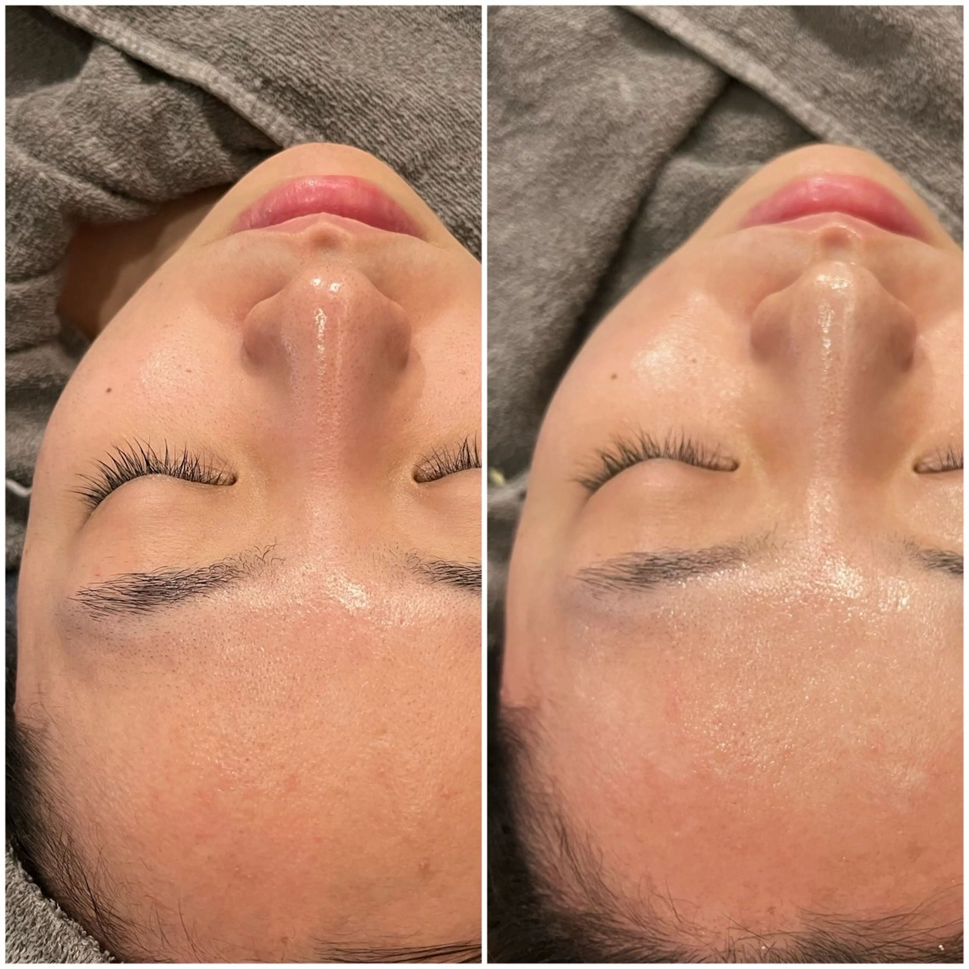 リラク yellow.所属・yellow💛【 脱毛&フェイシャル】のエステ・リラクイメージ