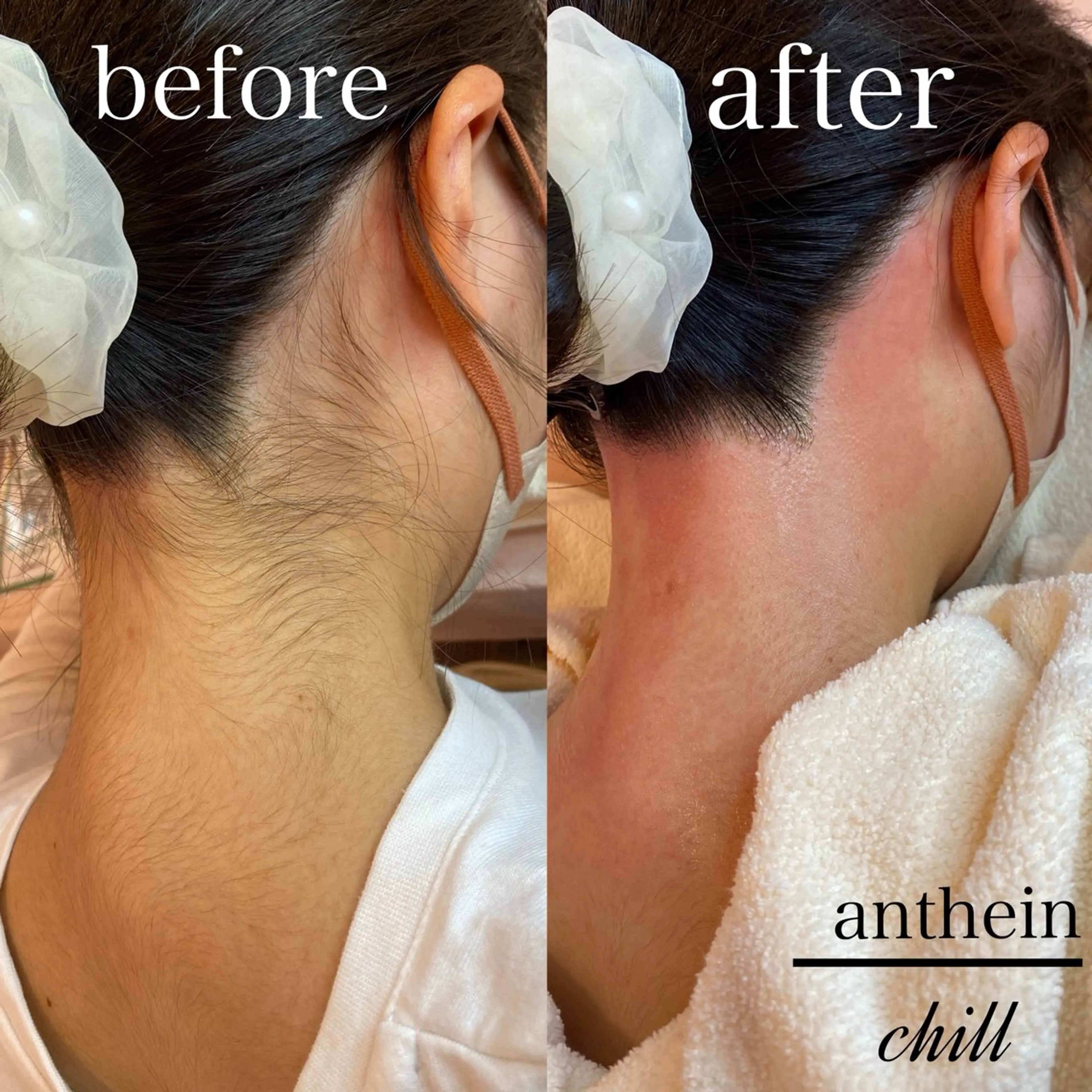 ✨【MIX脱毛うなじ✨】の写真