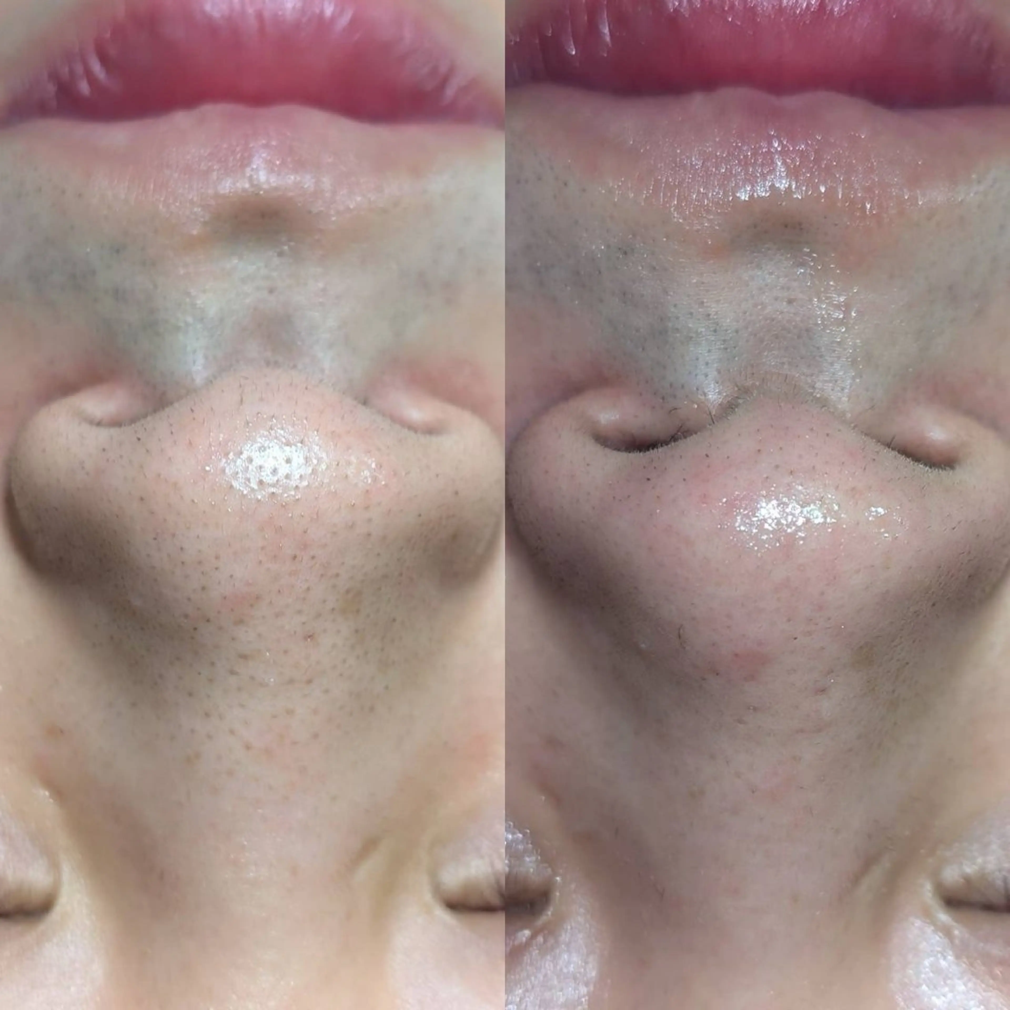 エステ Morphome所属・【Morphome】 hinaのエステ・リラクイメージ