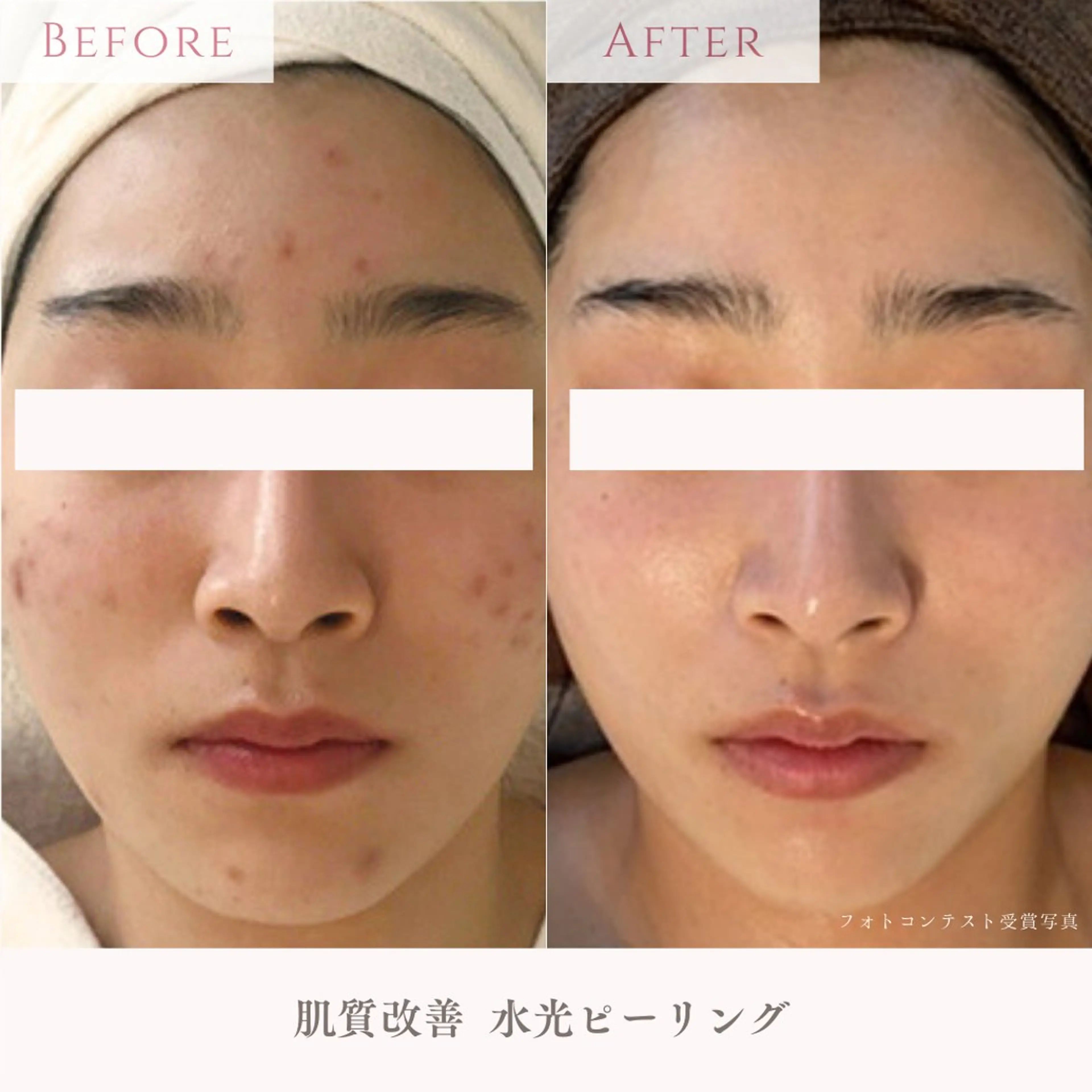 エステ 肌質改善サロン LesFleursのエステ・リラクイメージ