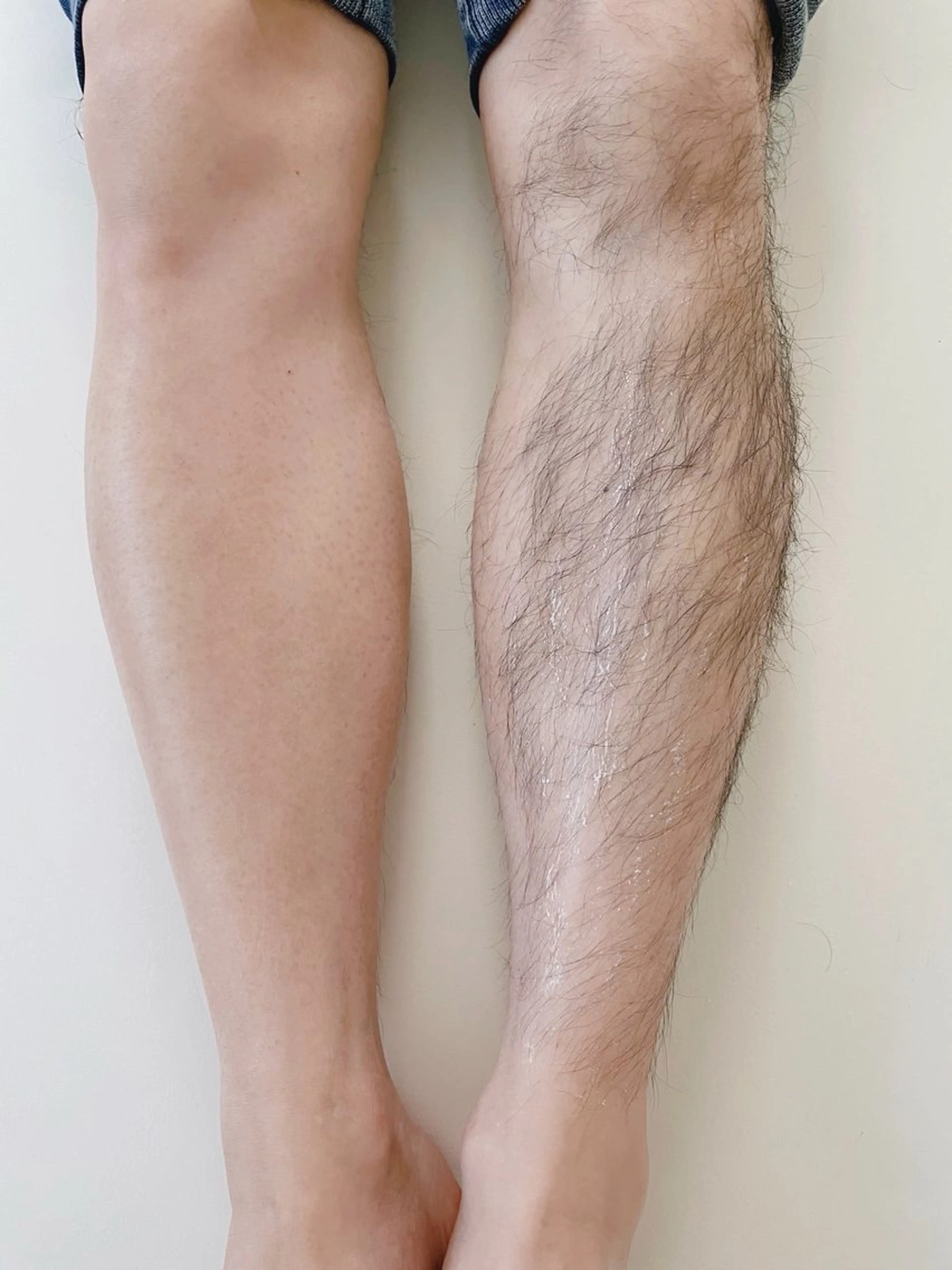 シュガーリング　脚の写真