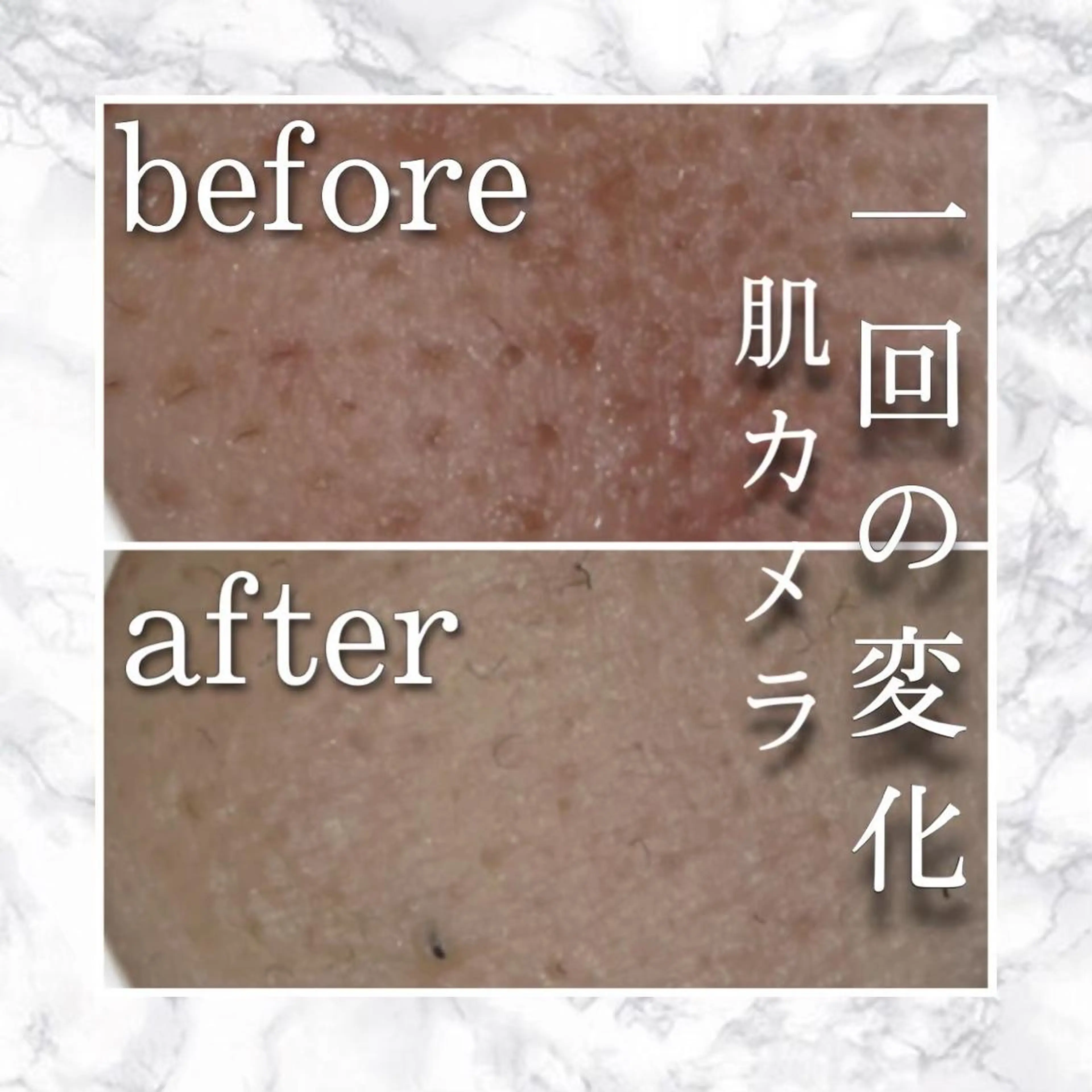 セミロング カラー パーマ ヘアアレンジ メンズ キッズ ネイル マツエク・マツパ アイブロウ エステ リラク ニキビ特化型エステ 🍓最短で肌質改善のエステ・リラクイメージ