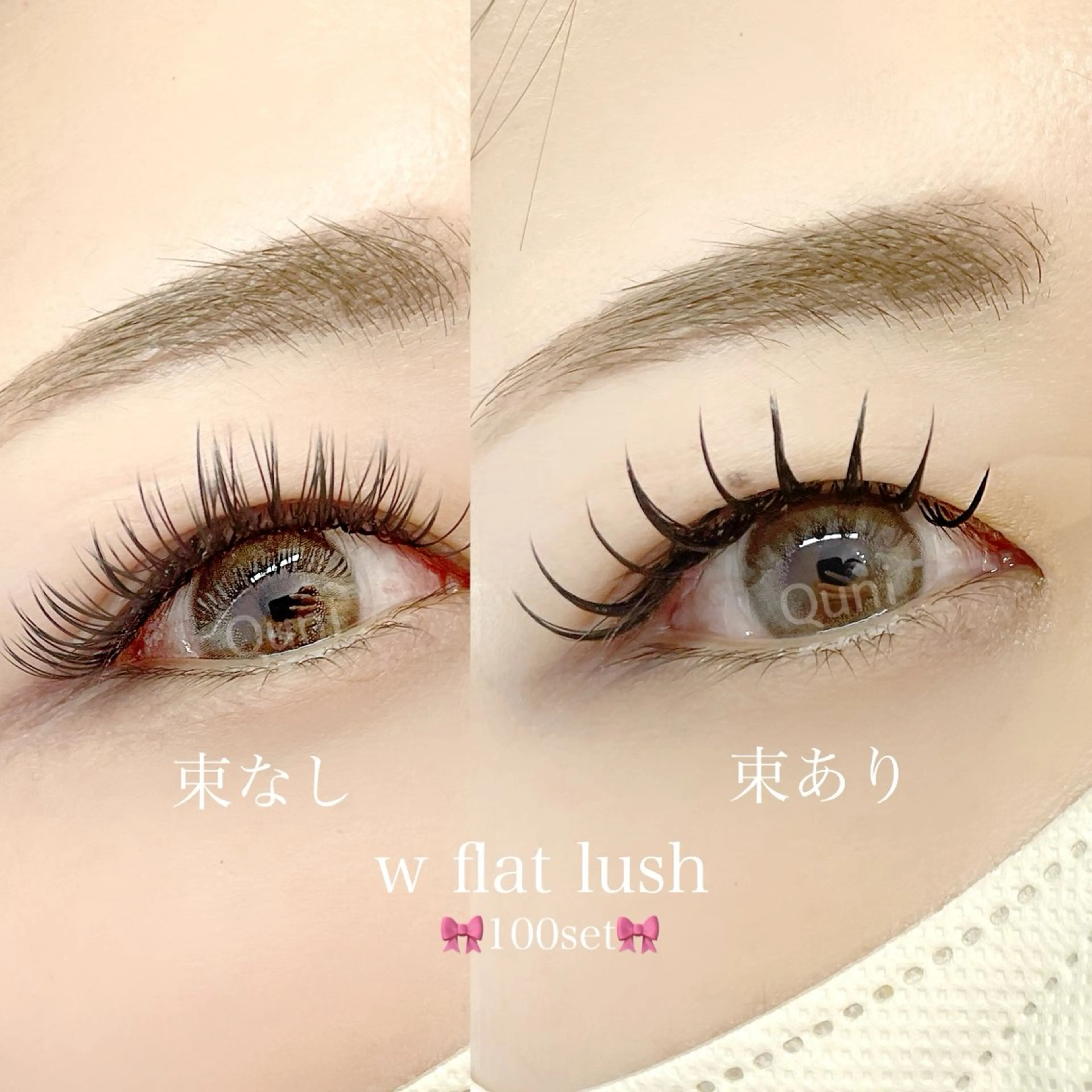 w flat 200本(100set)の写真