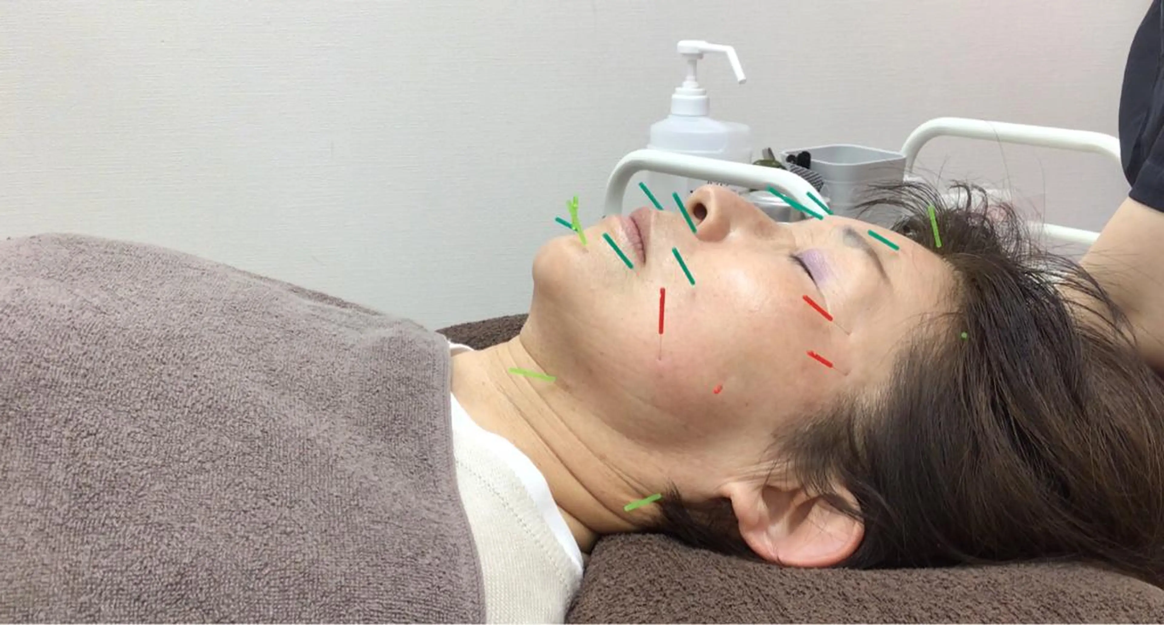 エステ リラク まごころ鍼灸整骨院所属・まごころ鍼灸整骨院 京王堀之内院のエステ・リラクイメージ