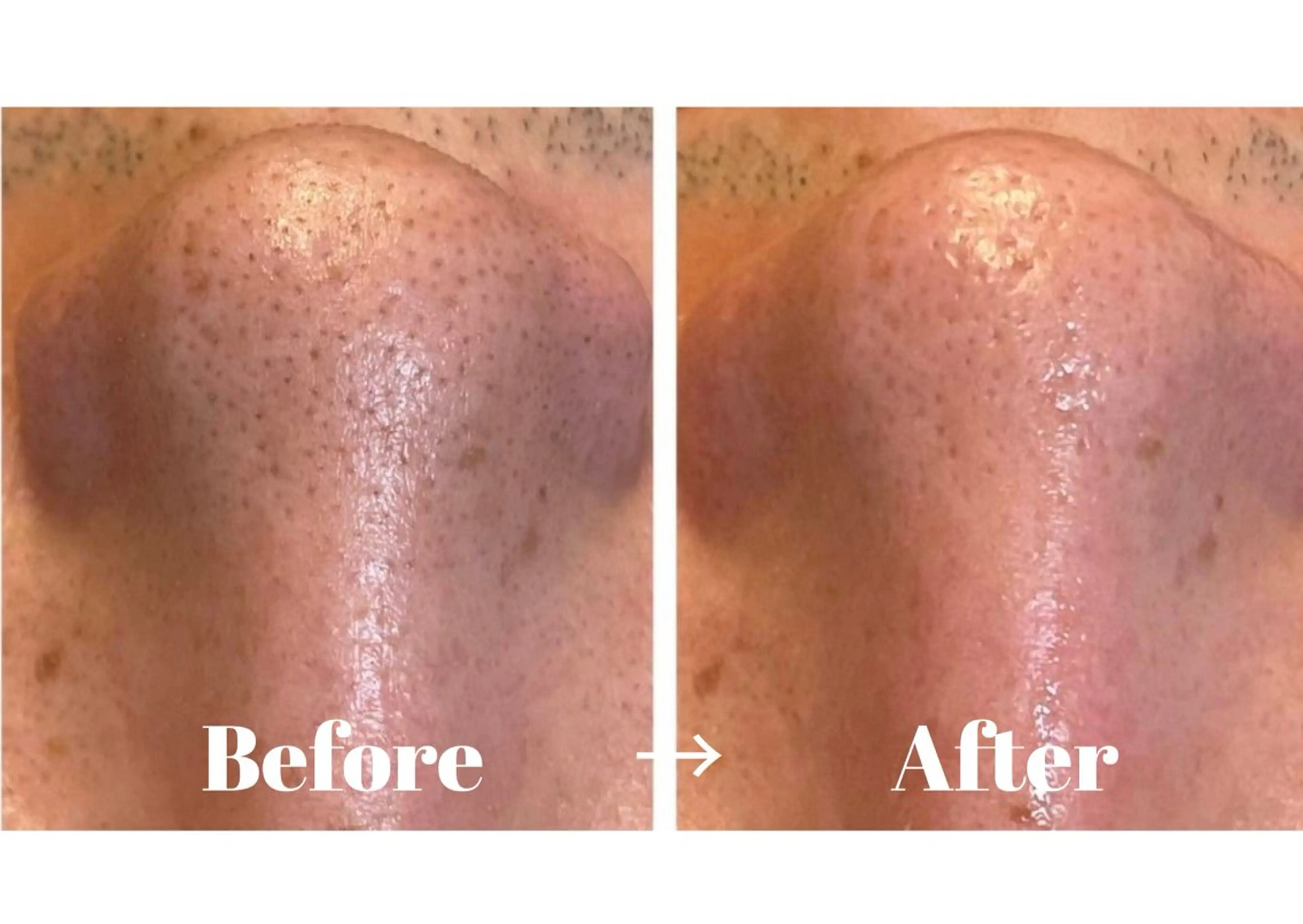 エステ よもぎ蒸しエステサロン★yun所属・よもぎ蒸しサロン ゆんのエステ・リラクイメージ