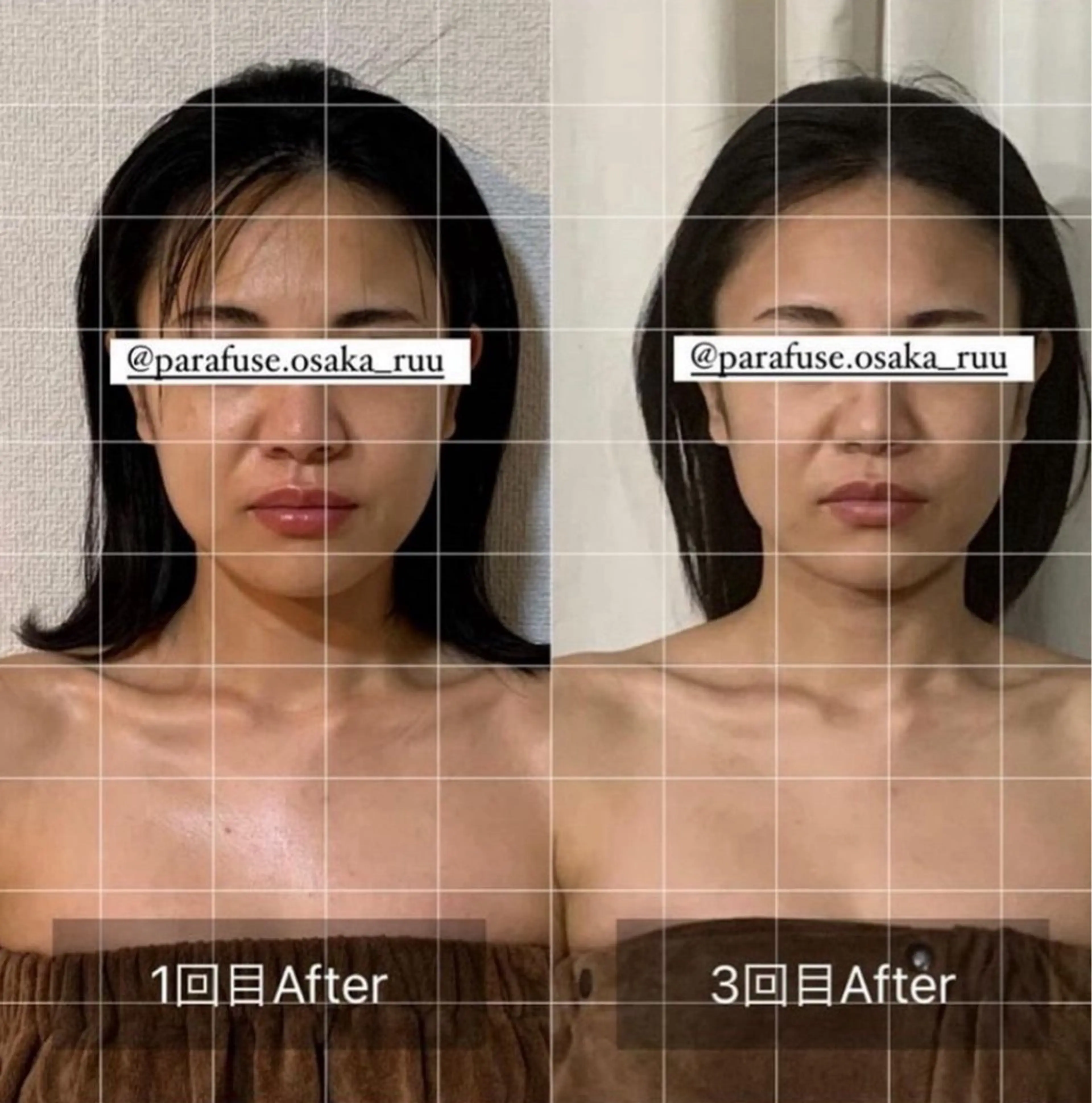 エステ リラク 【頭痛、睡眠改善】 salon RUUのエステ・リラクイメージ