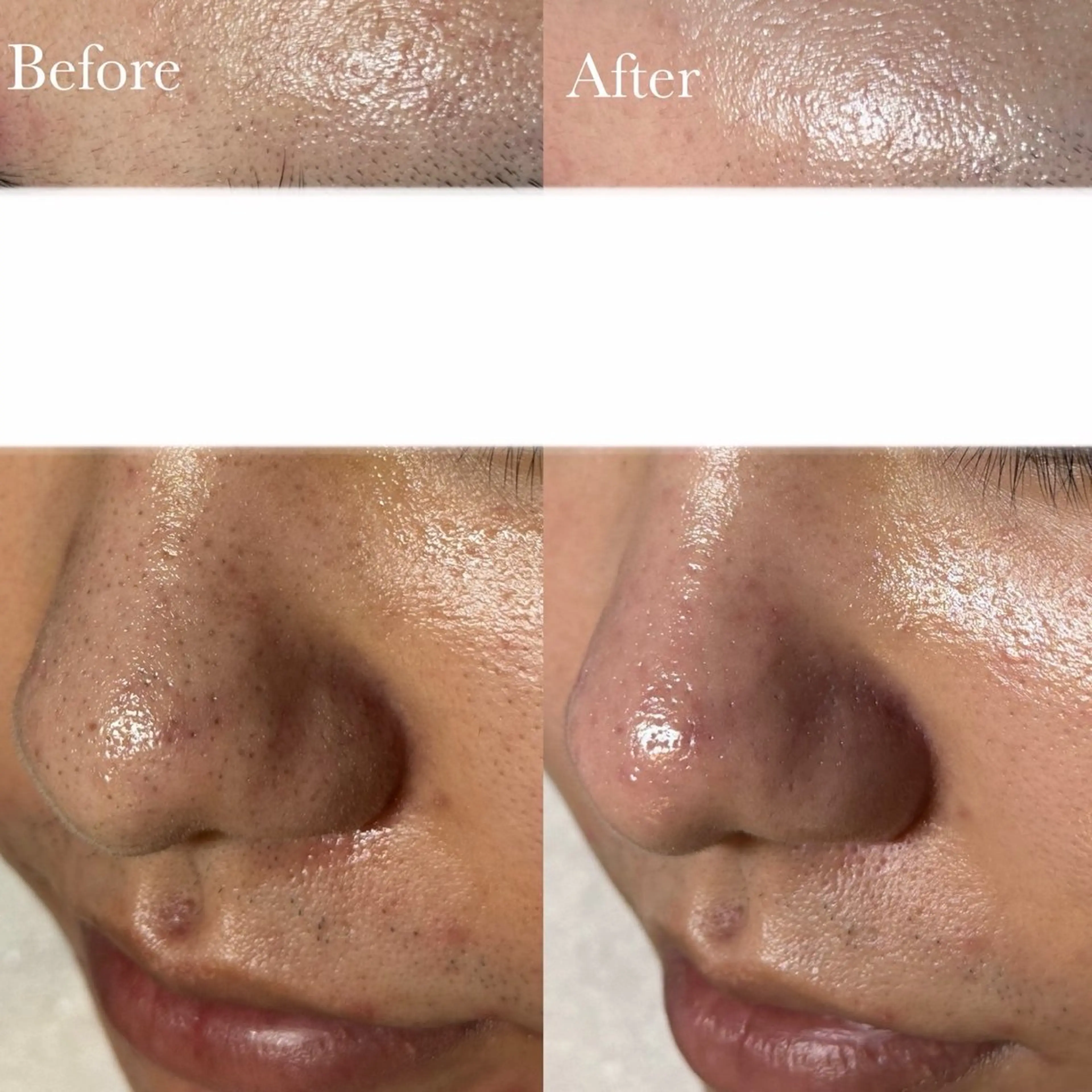 エステ SHELLY 池本知香のエステ・リラクイメージ