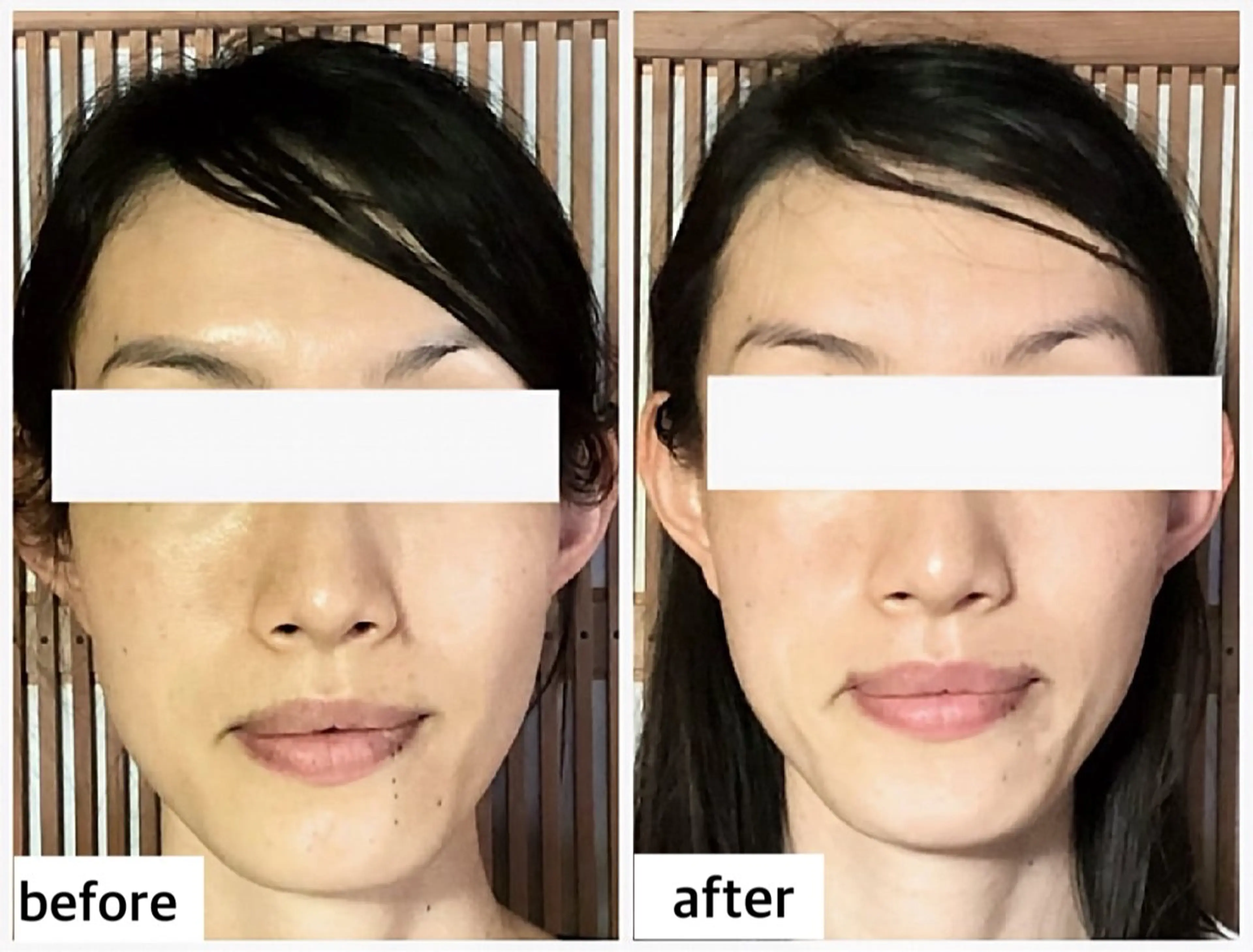 エステ リラク ルコナビューティ所属・小顔・歪み専門　井元 朋子のエステ・リラクイメージ