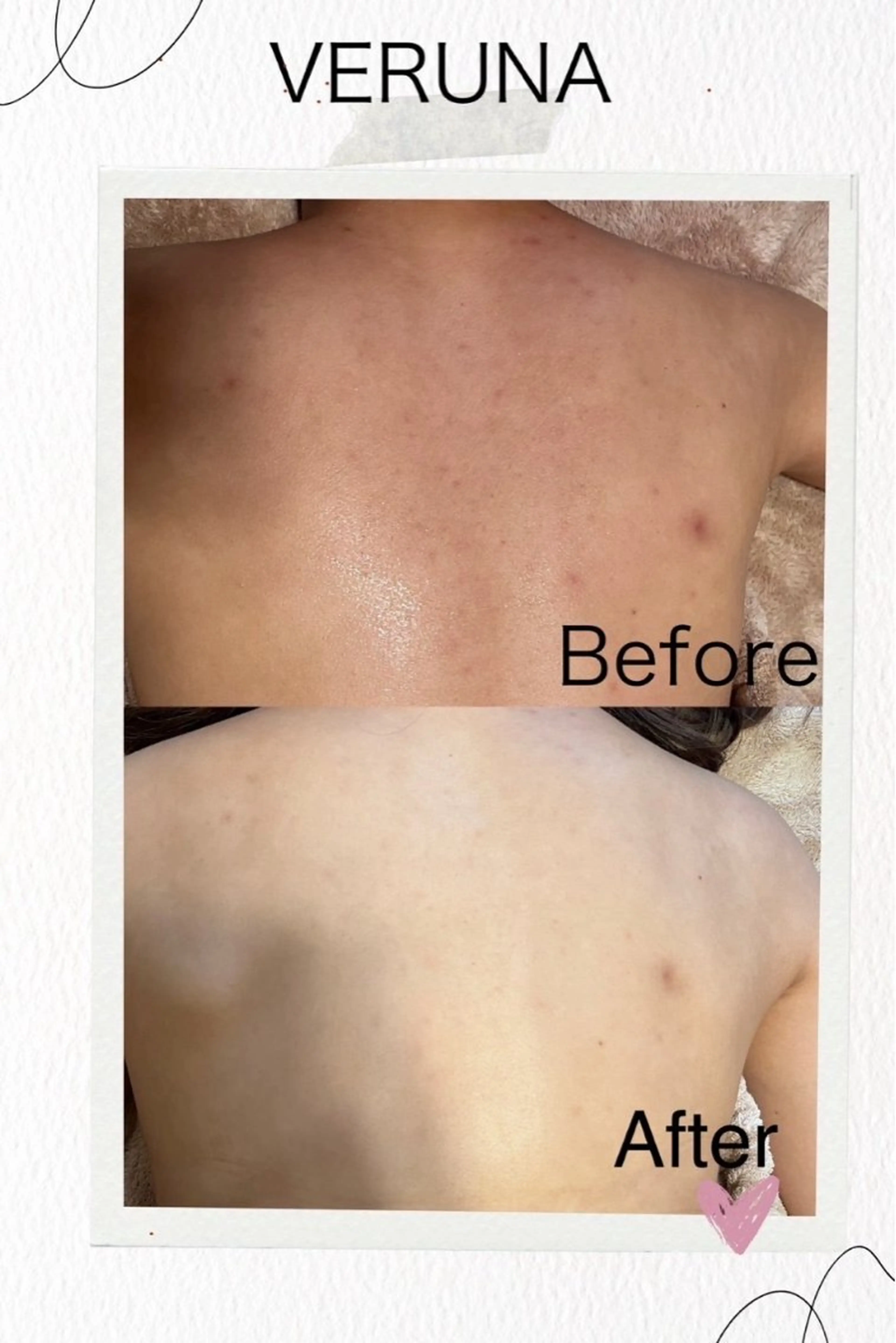 エステ ニキビ改善専門店 d'Albaのエステ・リラクイメージ