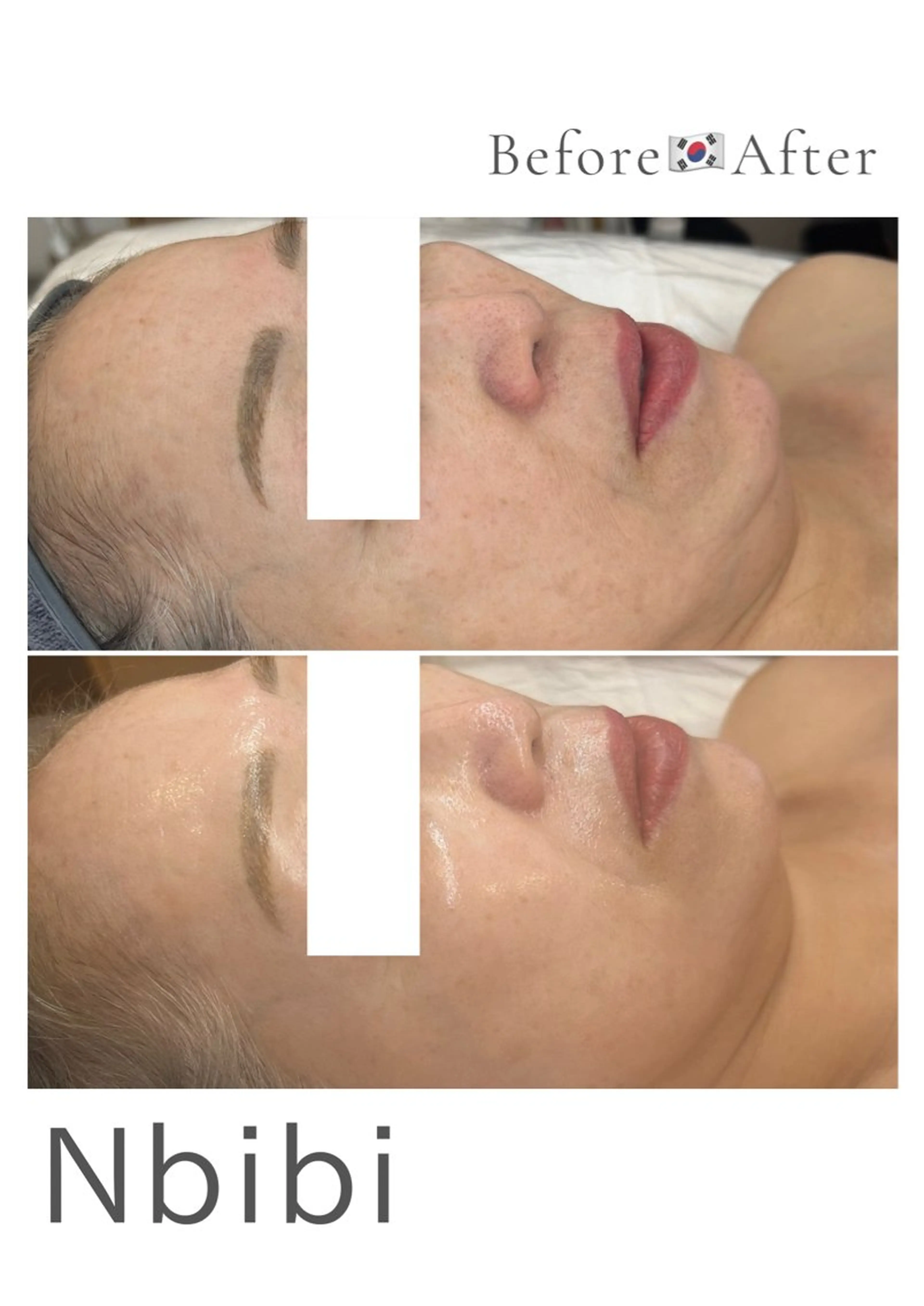 韓国🇰🇷価格 サロン_Nbibiのエステ・リラクイメージ