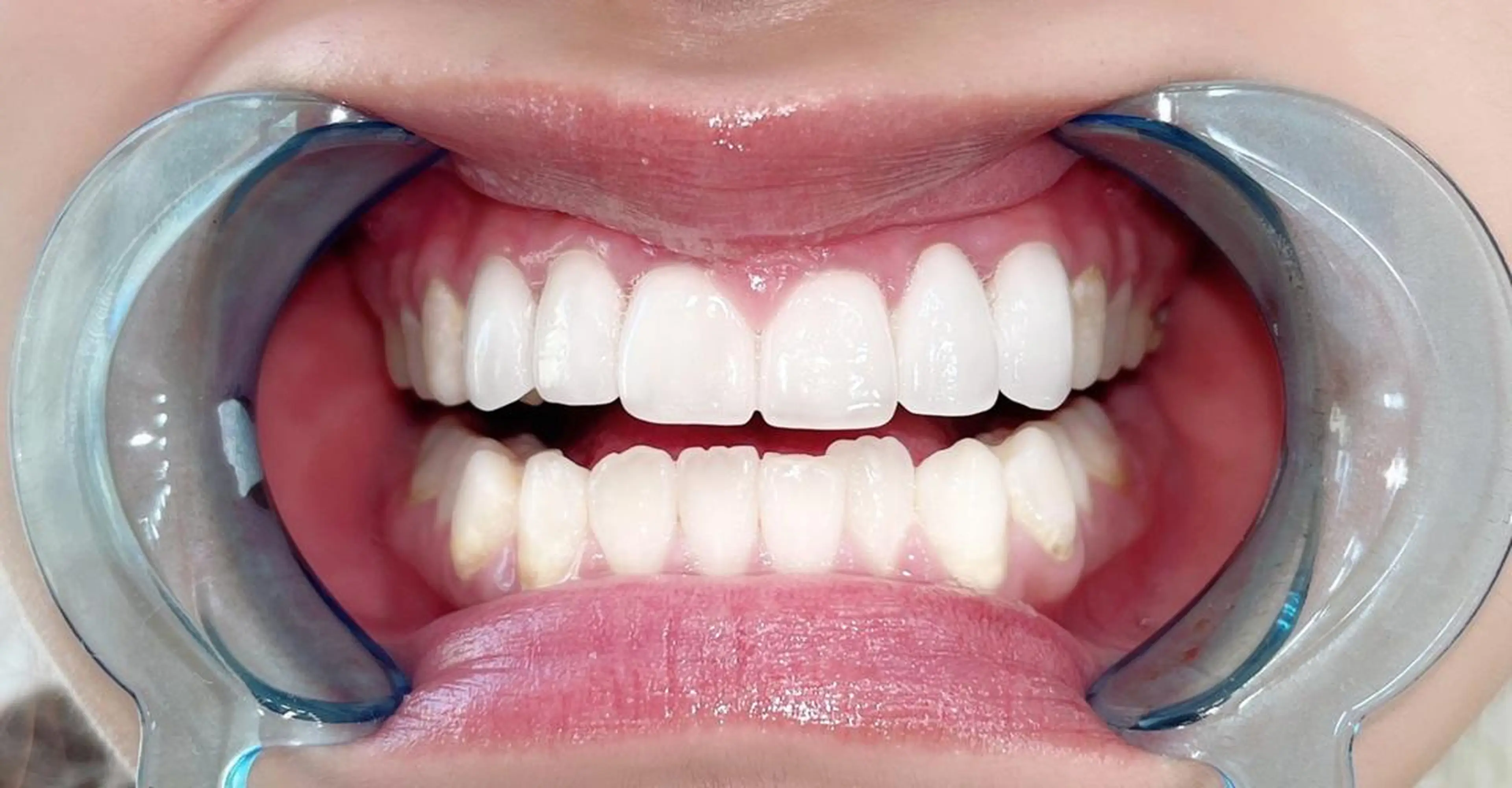 メンズ ライトビューティー 錦糸町店のエステ・リラクイメージ