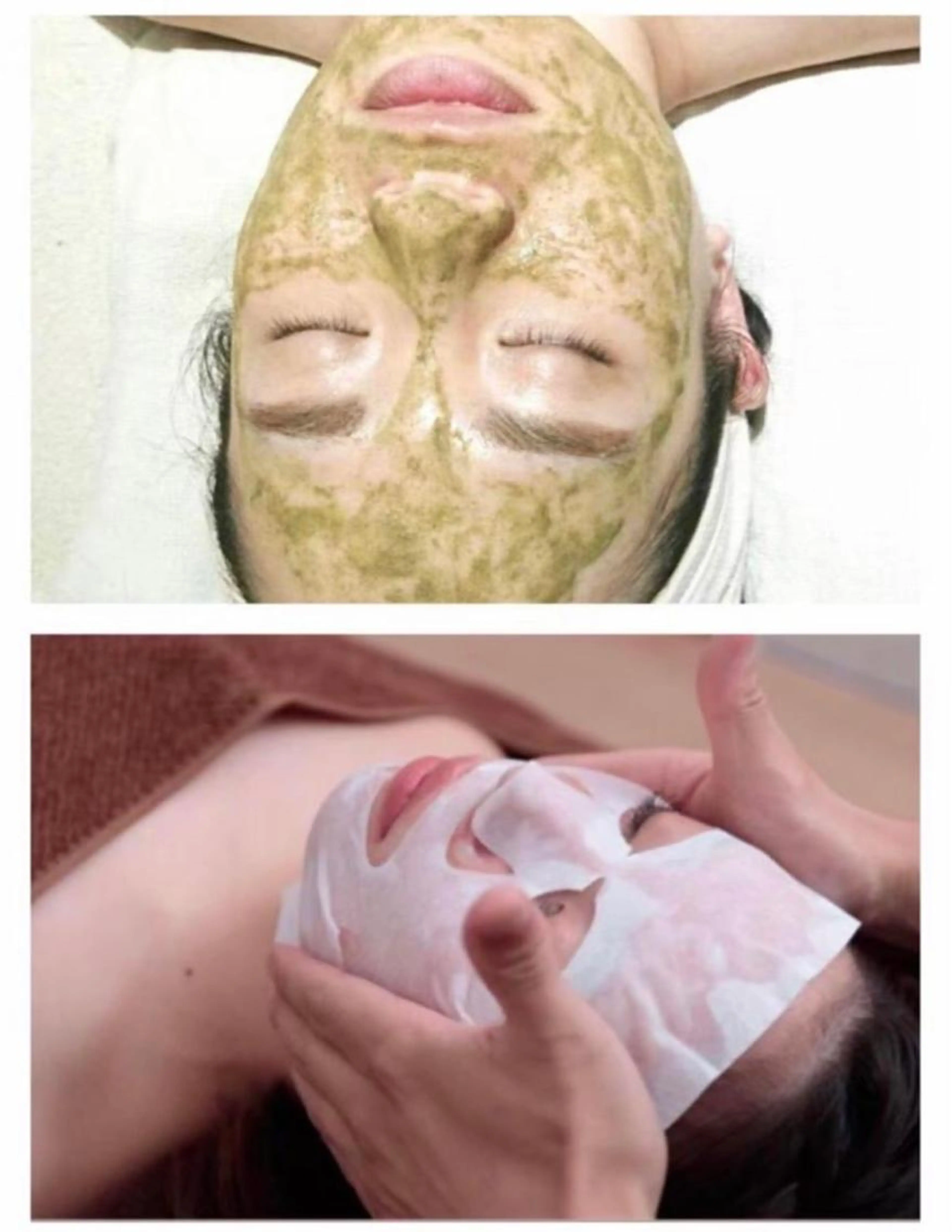 超美肌/陶器肌🌿🫧 【 ハーブピーリング＋カーボキシー炭酸ガス 】初回¥7,900の写真