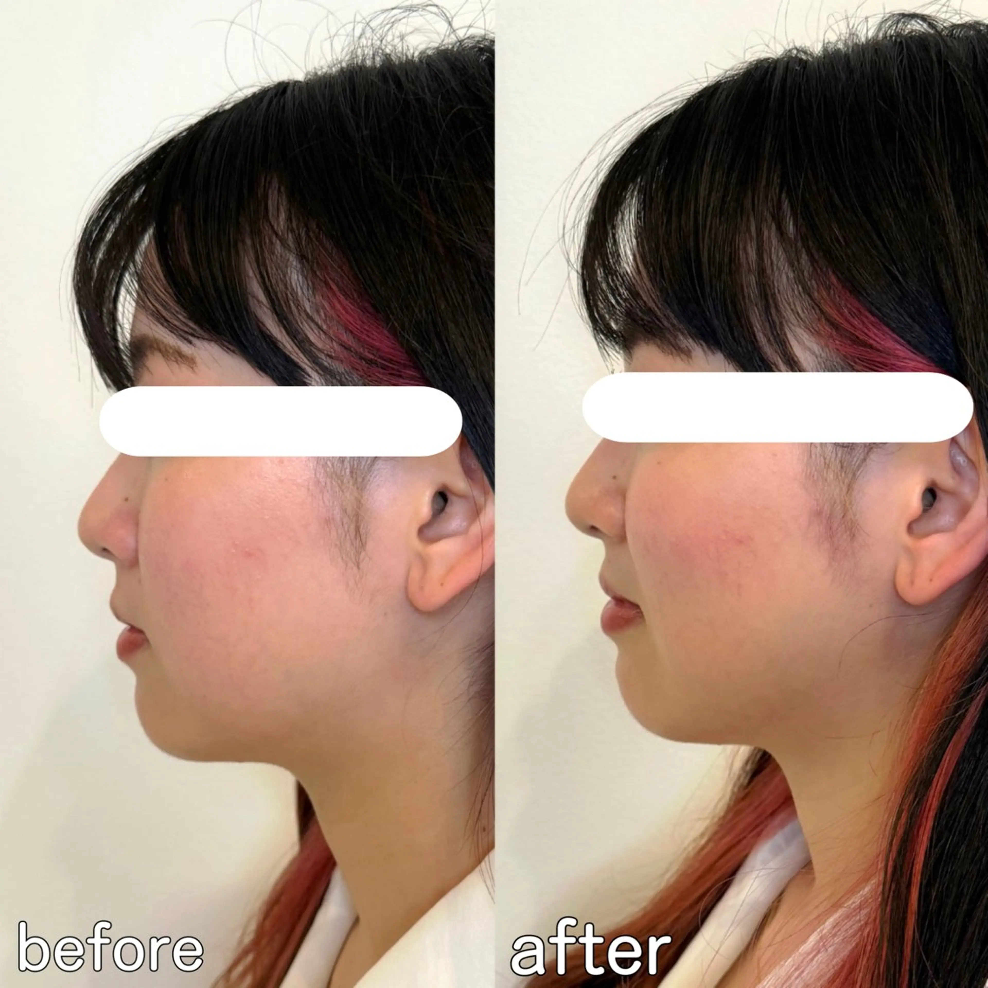 小顔矯正&美容整体 整え屋REDオーナーのエステ・リラクイメージ