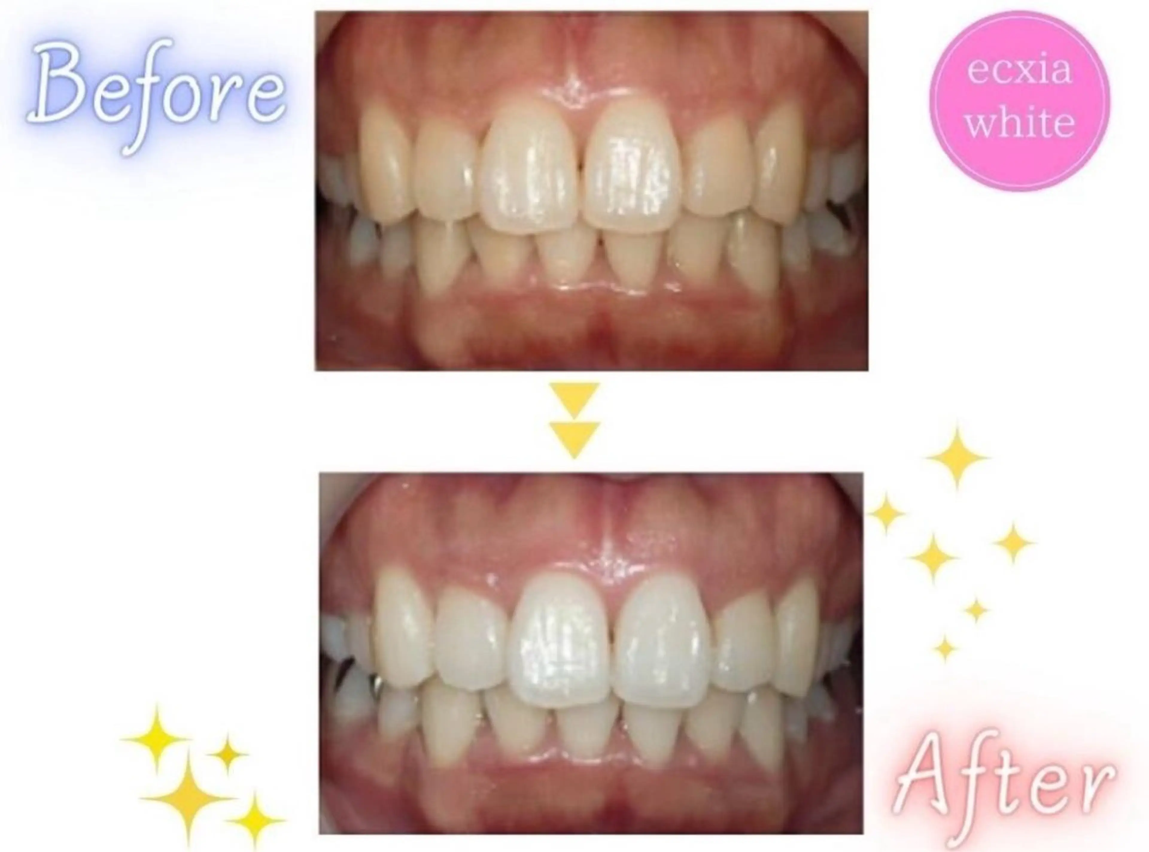 セルフホワイトニング エクシア武蔵小杉店のその他イメージ