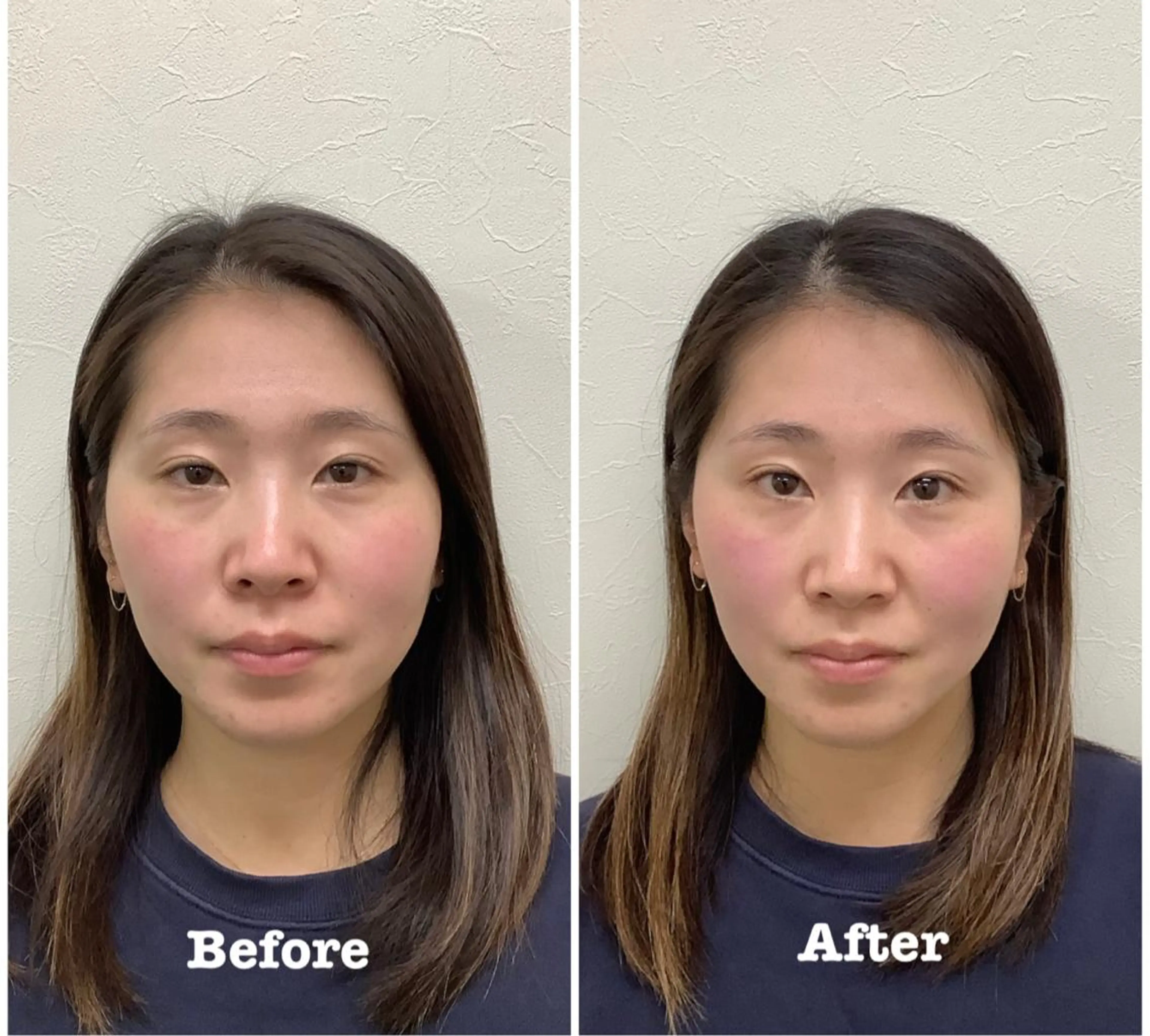 エステ リラク だいち 鍼灸院　伊伝居院のエステ・リラクイメージ