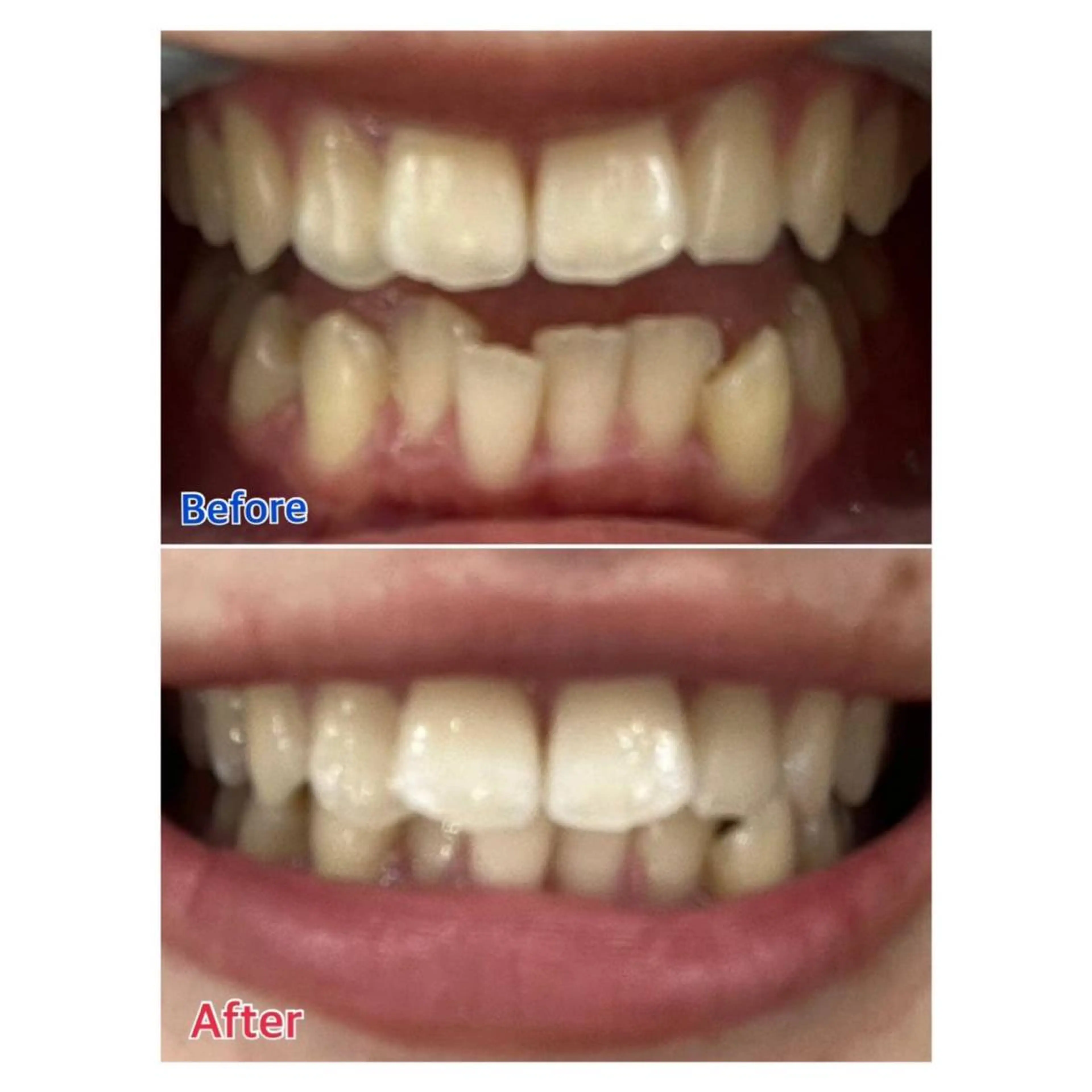 MBEAUTYSALON 千葉店・京成大久保所属・Melty 輝のその他イメージ