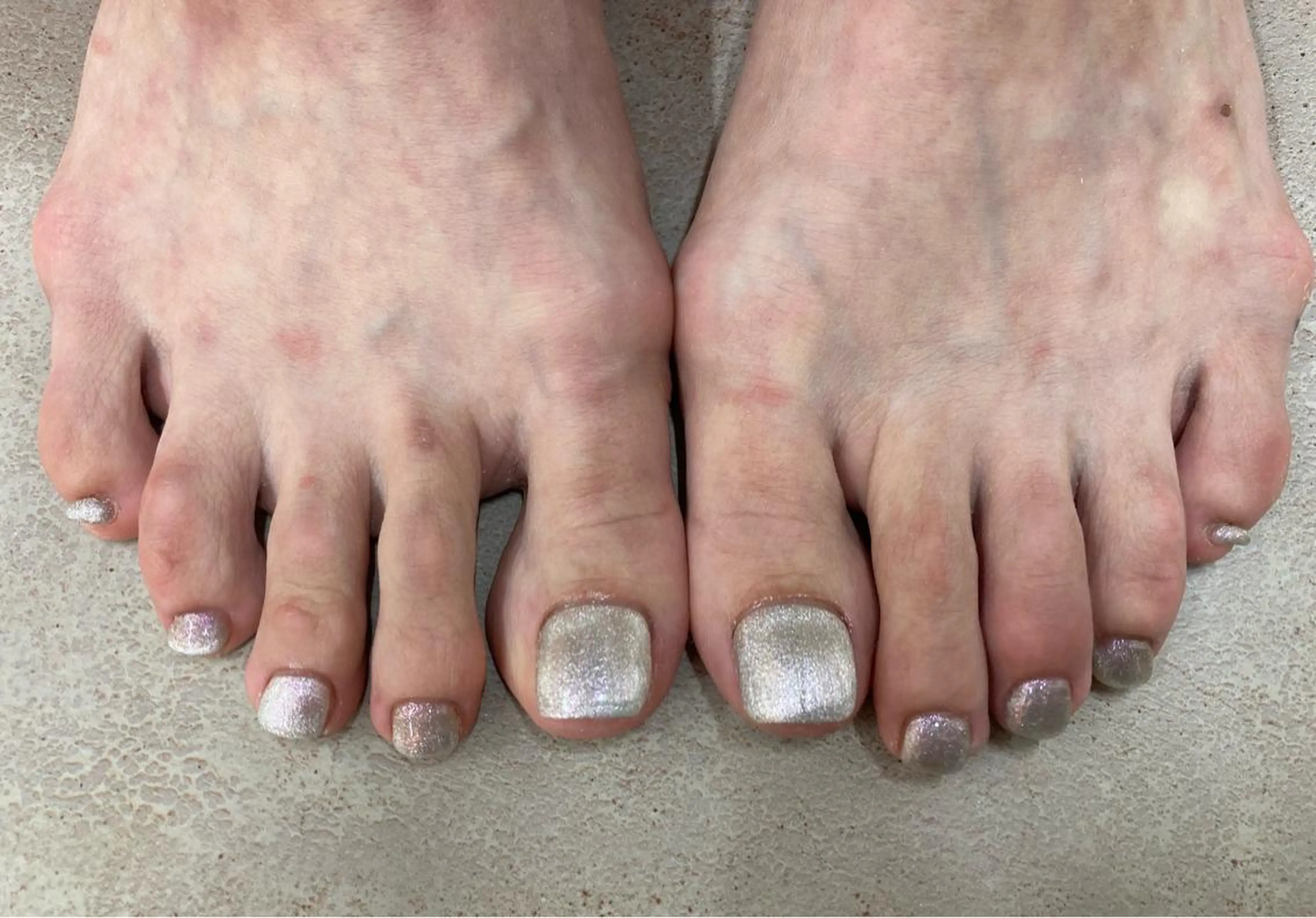 ネイル フットネイル マグネットネイル Maple所属・Maple saronのネイルデザイン