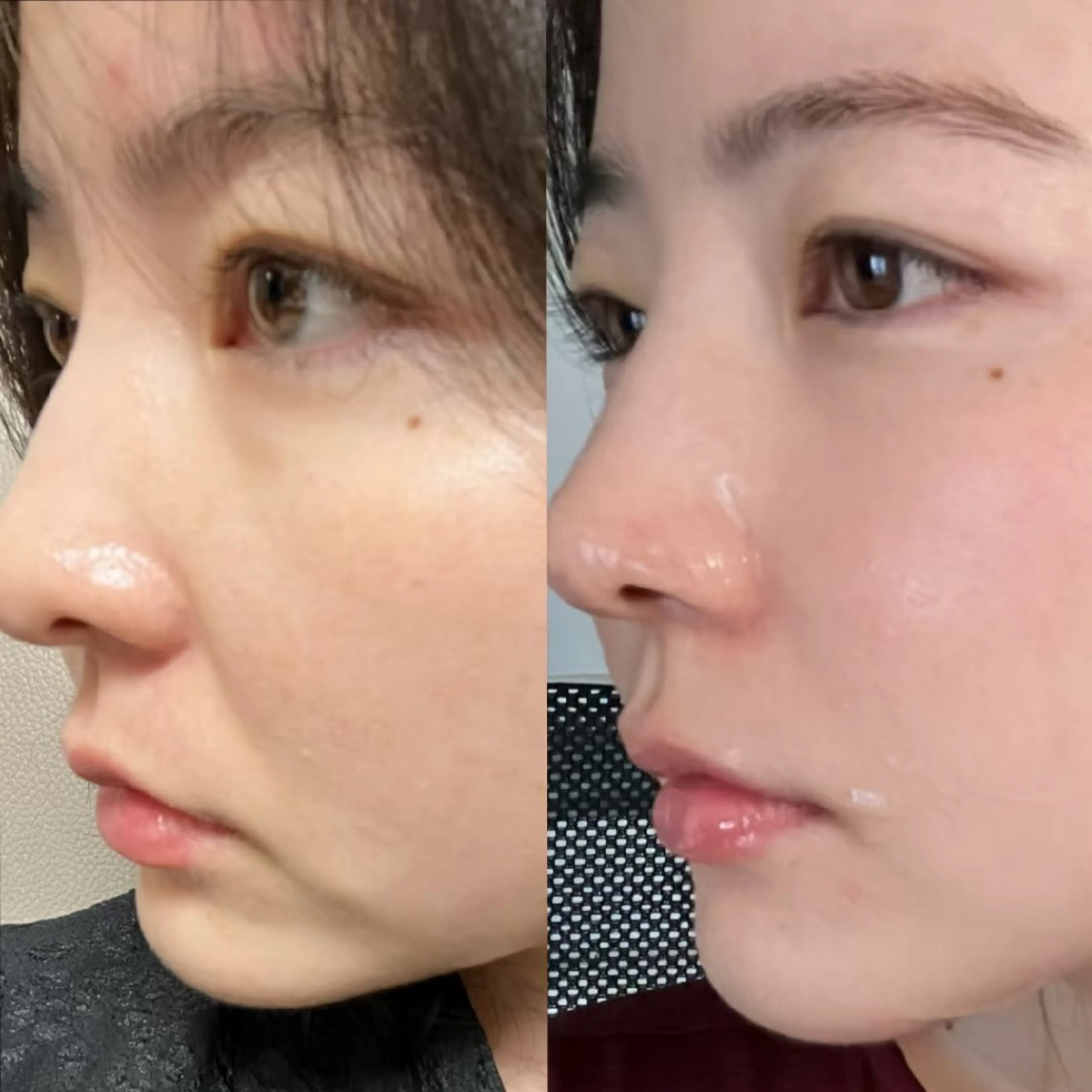 エステ aliaハイフ&水光ジェットサロン所属・aliaハーブ水光店 エステティシャン募集のエステ・リラクイメージ