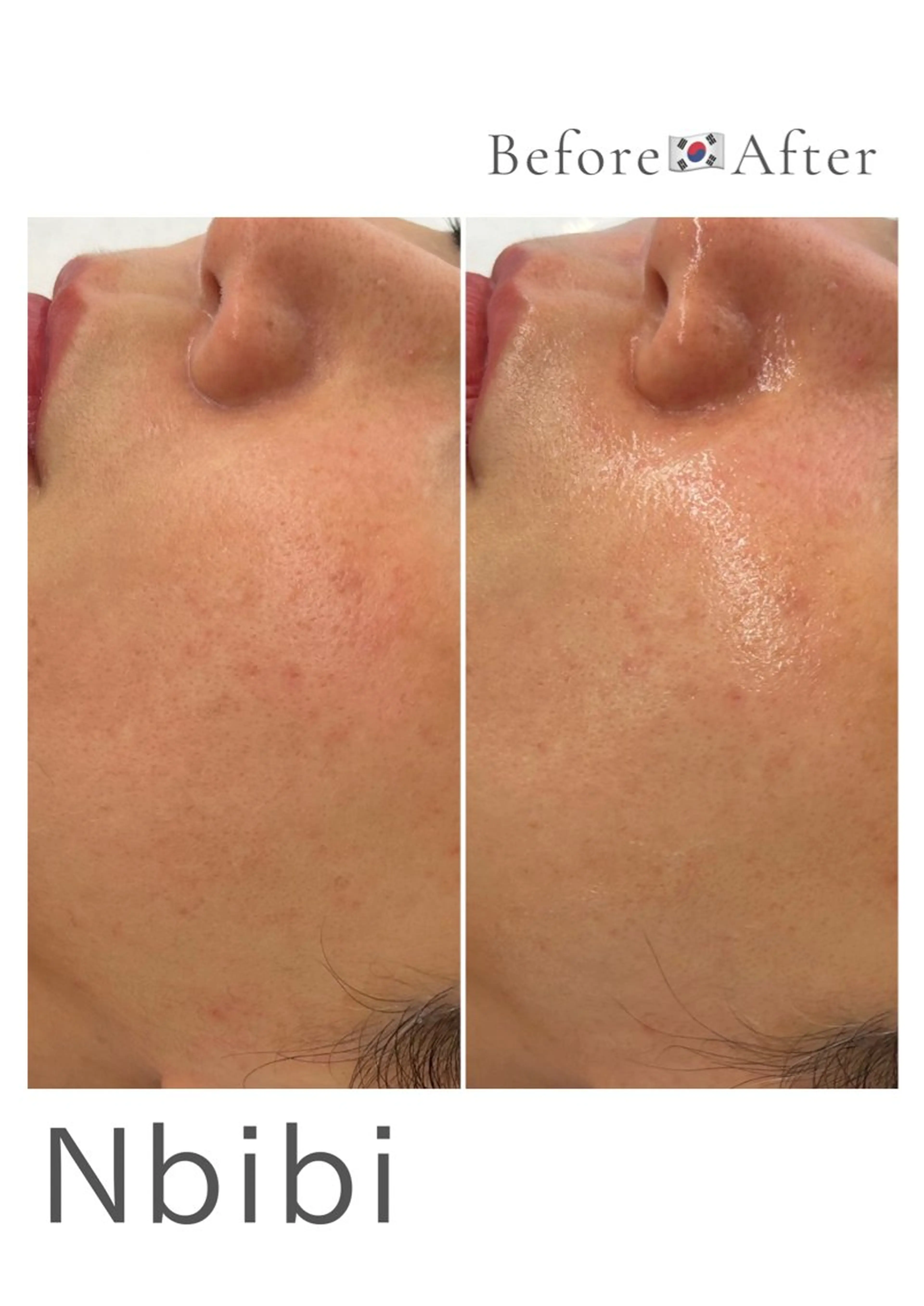 韓国🇰🇷価格 サロン_Nbibiのエステ・リラクイメージ