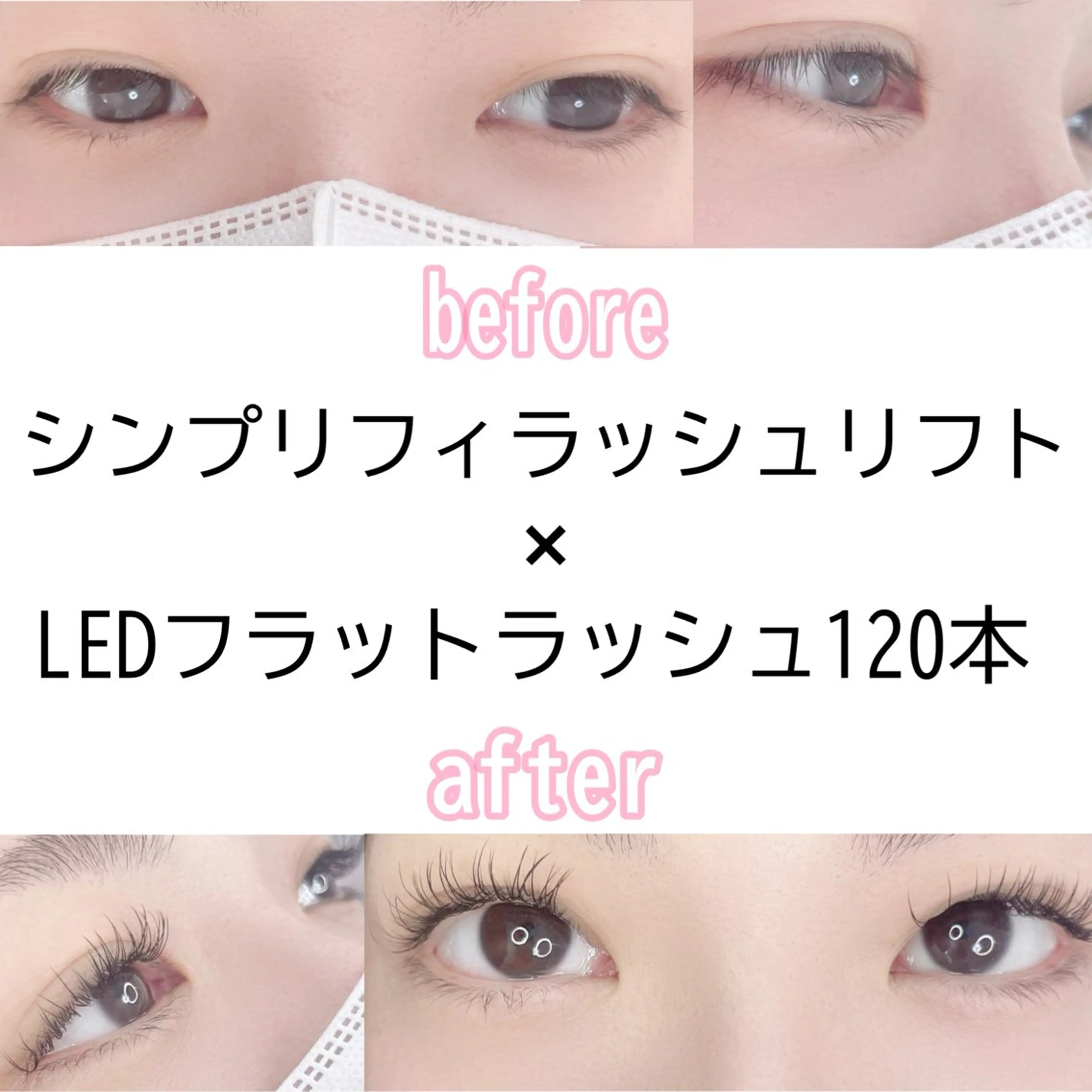 シンプリフィラッシュリフト+LEDフラット120本❤️オフ込み✨無添加美容液付きの写真