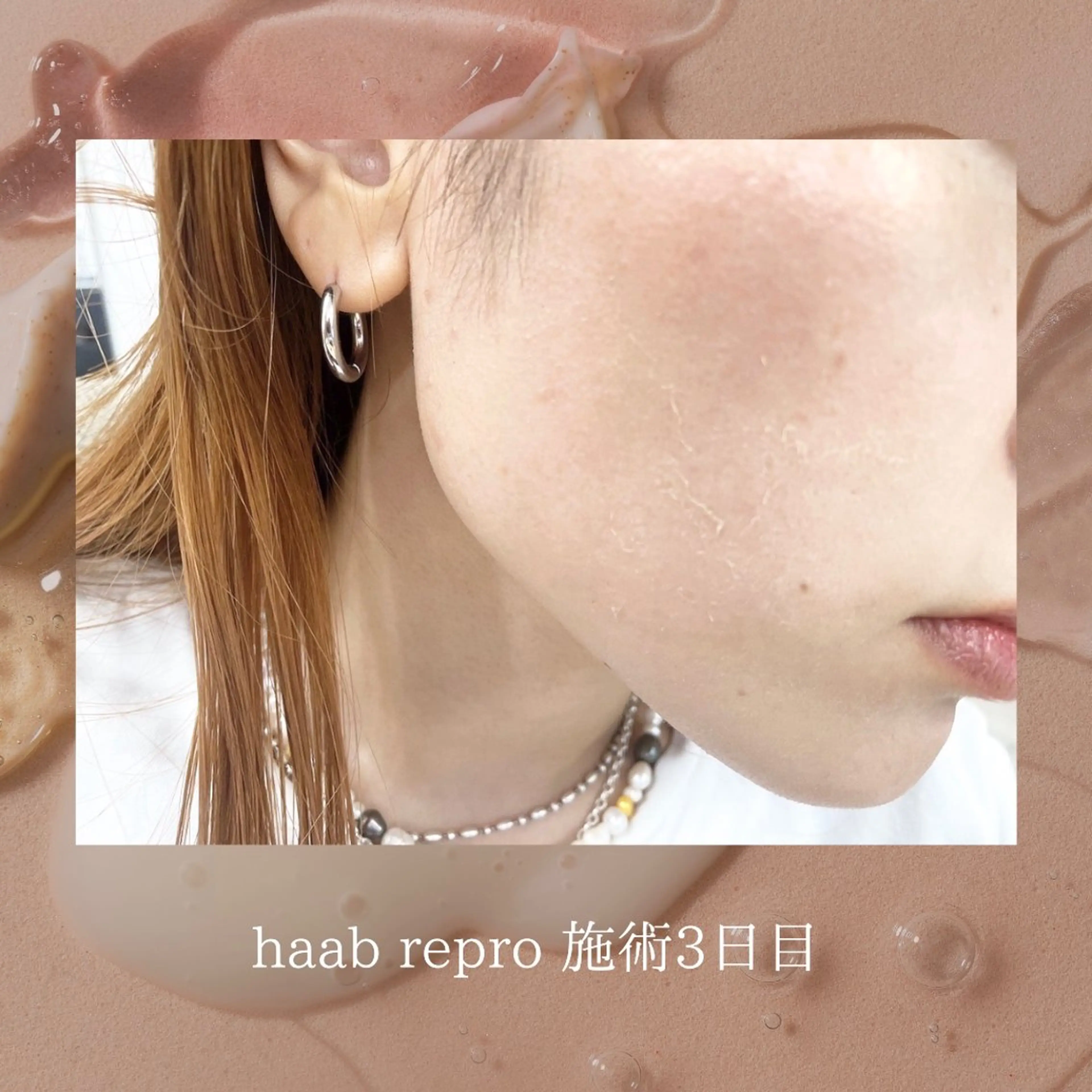 肌管理サロン neoriiのその他イメージ