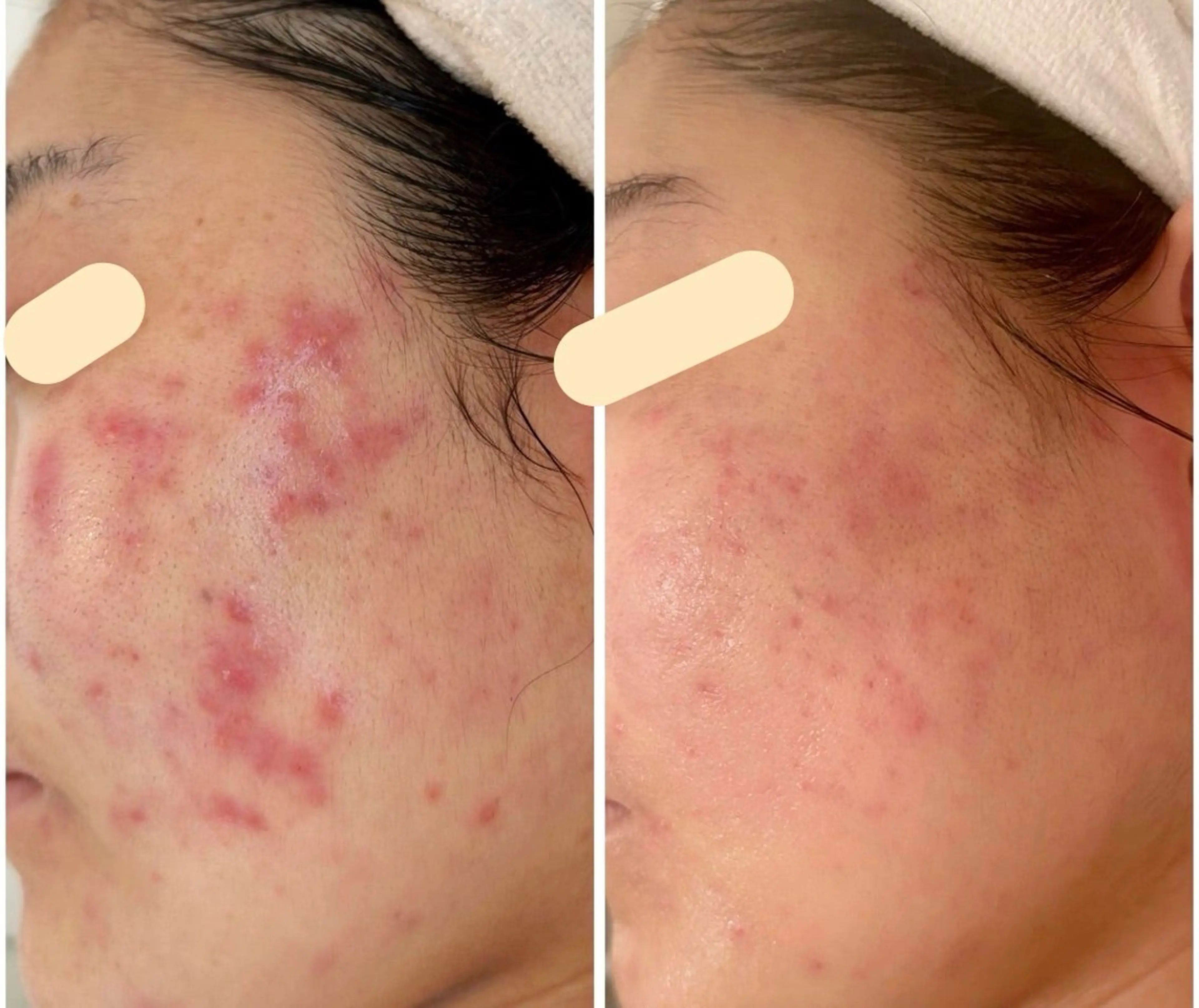 エステ 最速小顔・肌質管理 espoirマキのエステ・リラクイメージ