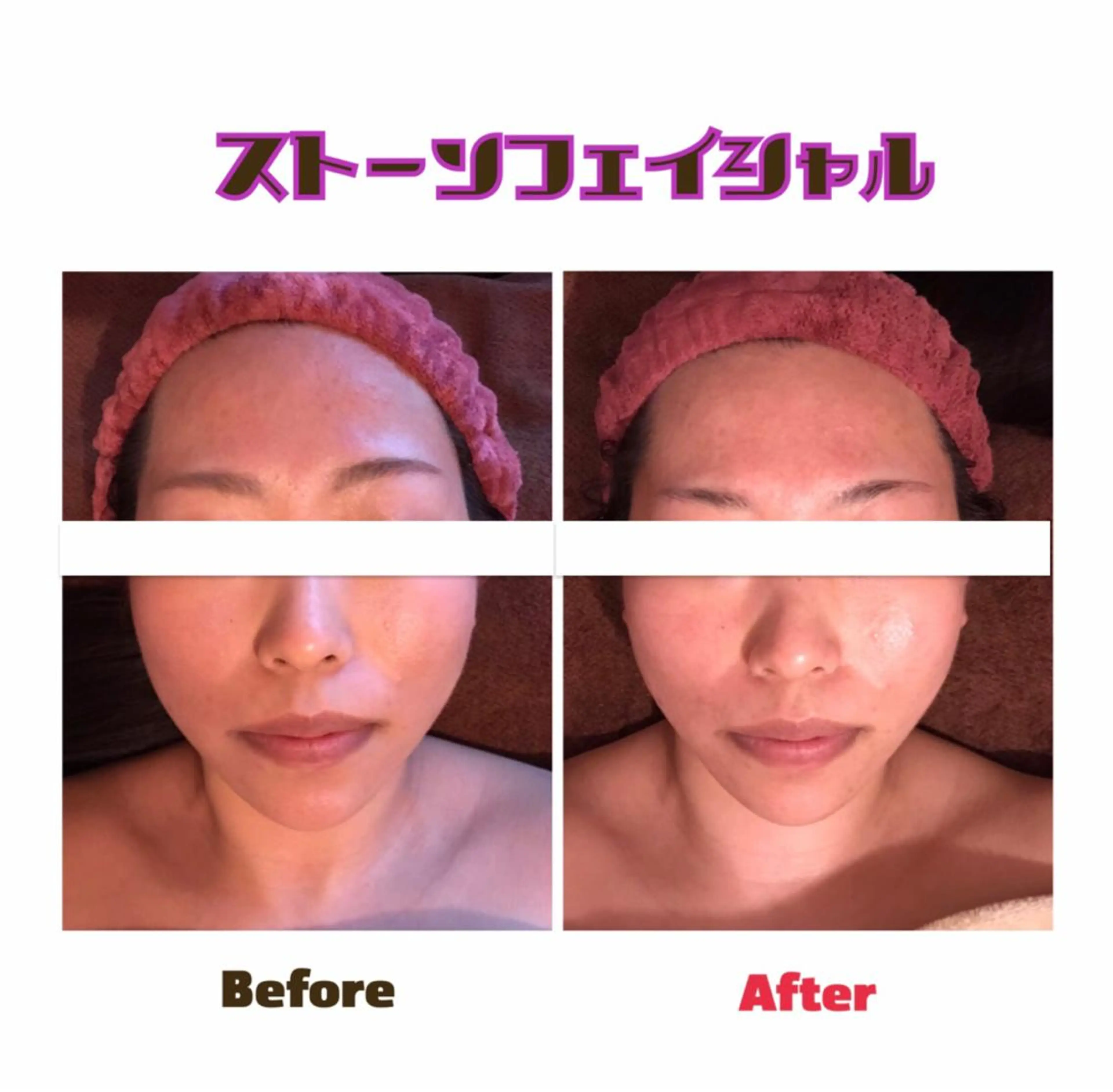 代表 MOMOのエステ・リラクイメージ