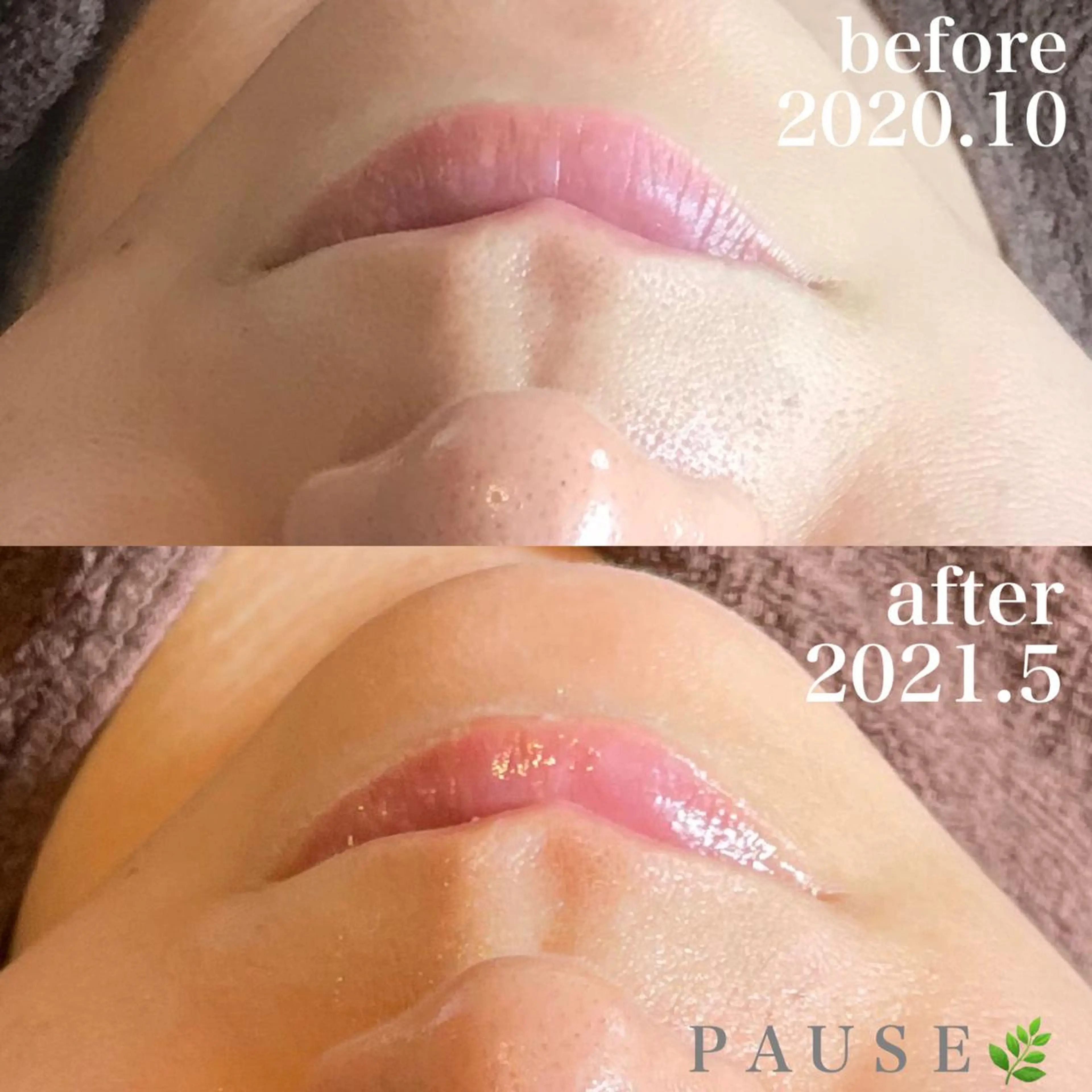 エステ 浜野 恵美のエステ・リラクイメージ