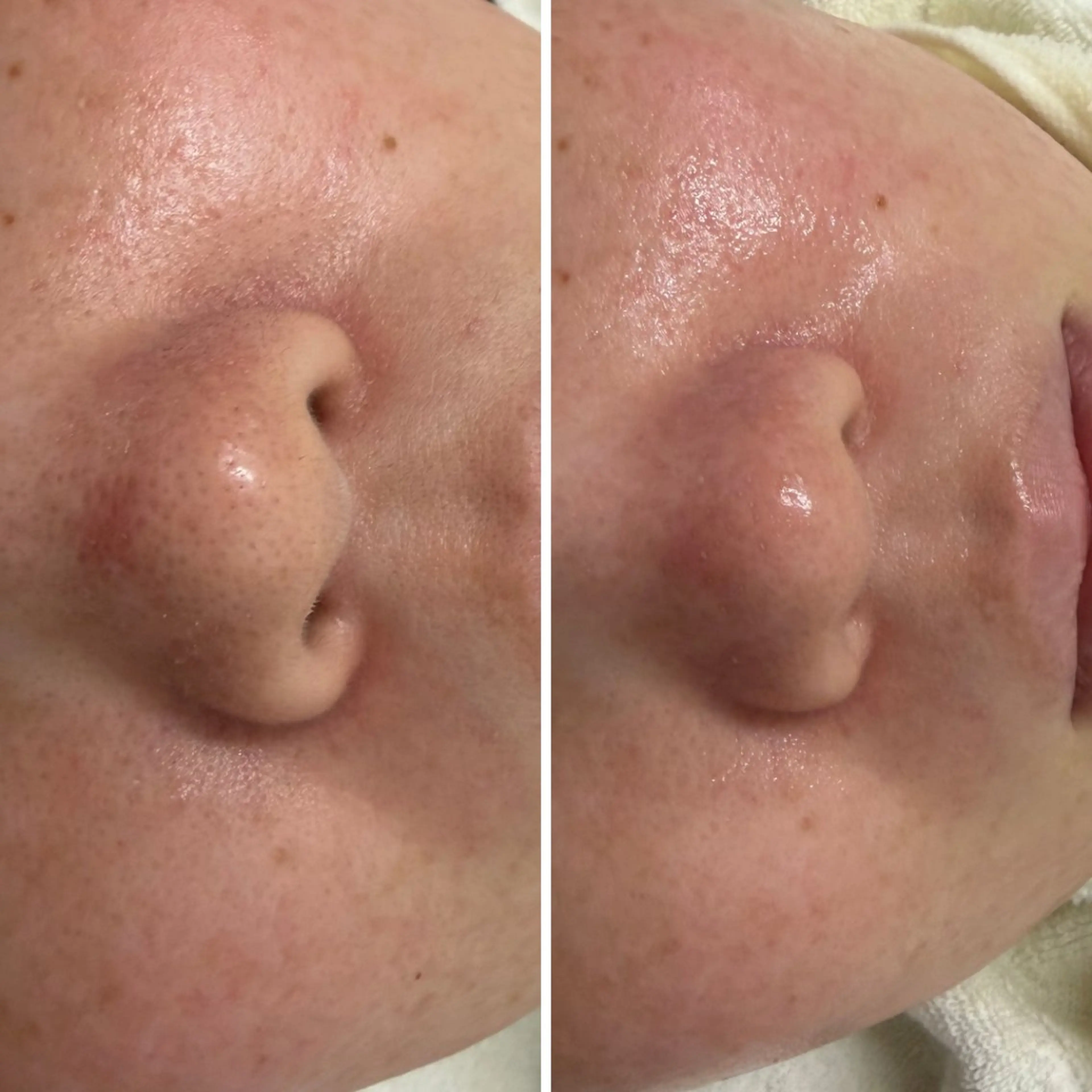 BLOOMi.(CARRIE NAIL内)所属・肌悩み専門店 BLOOMi.のエステ・リラクイメージ