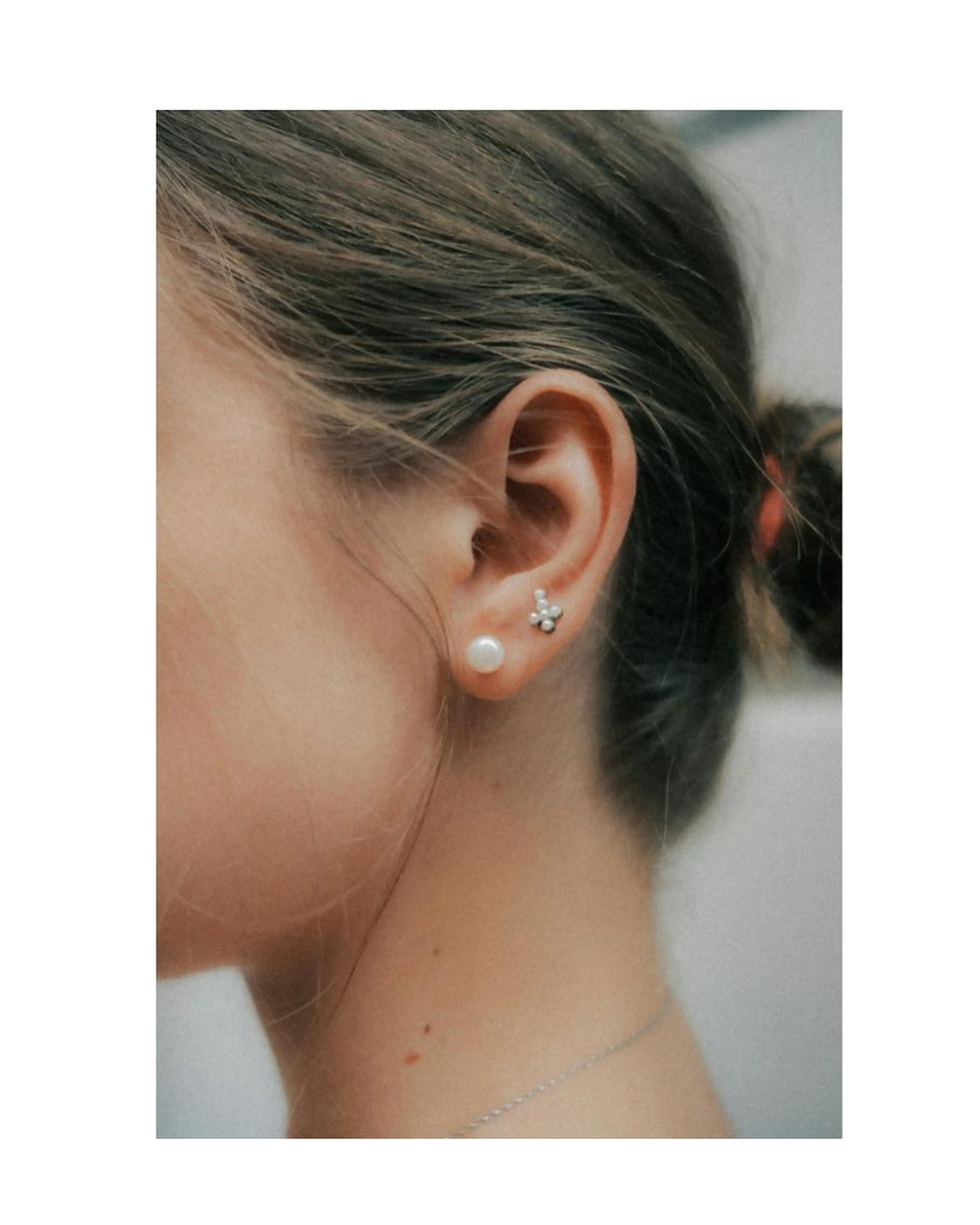 【うなじ脱毛】 バックスタイルも美しく.。.✨成人式に向けて.。.💐の写真