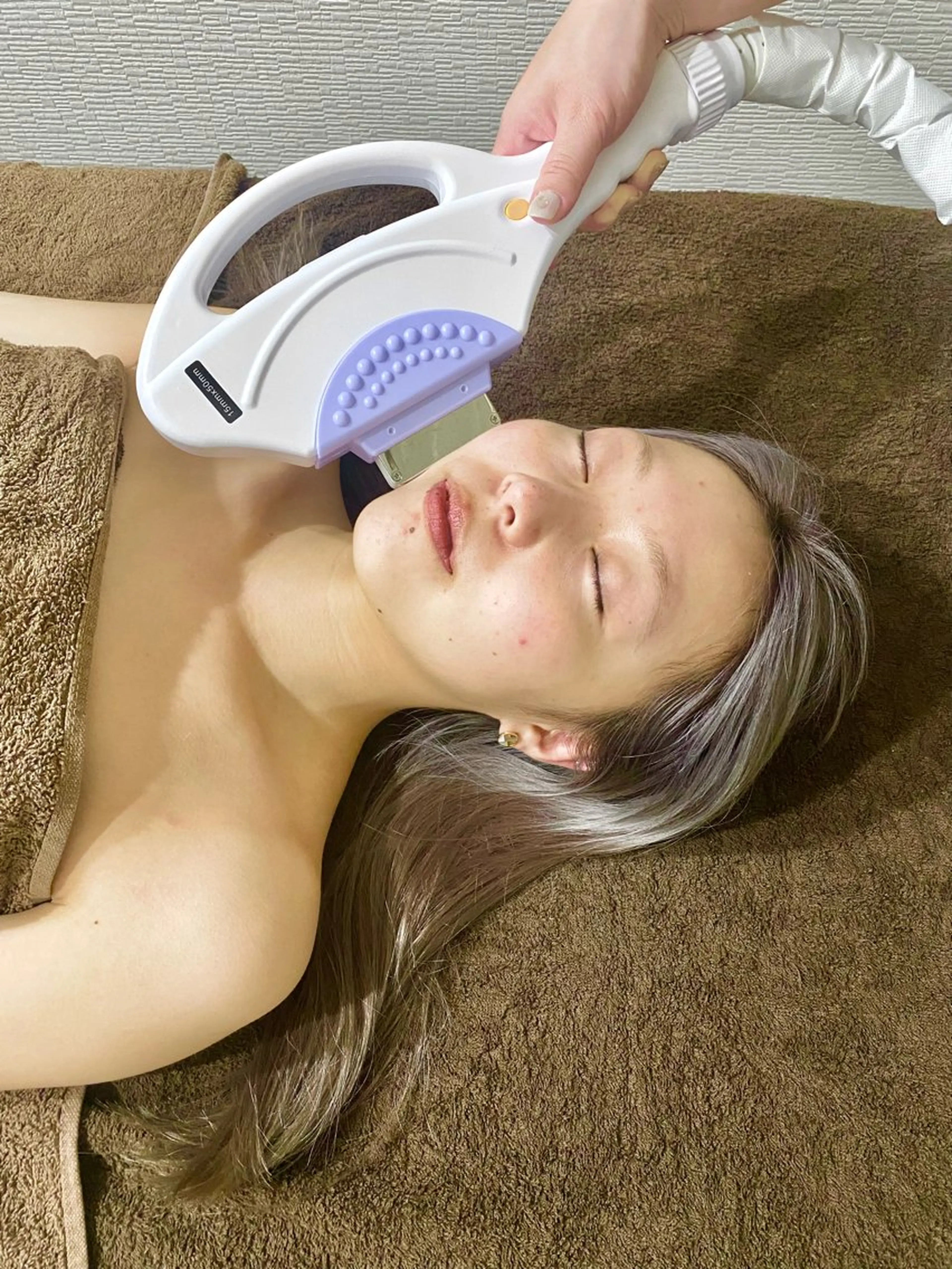 顔脱毛体験✨の写真