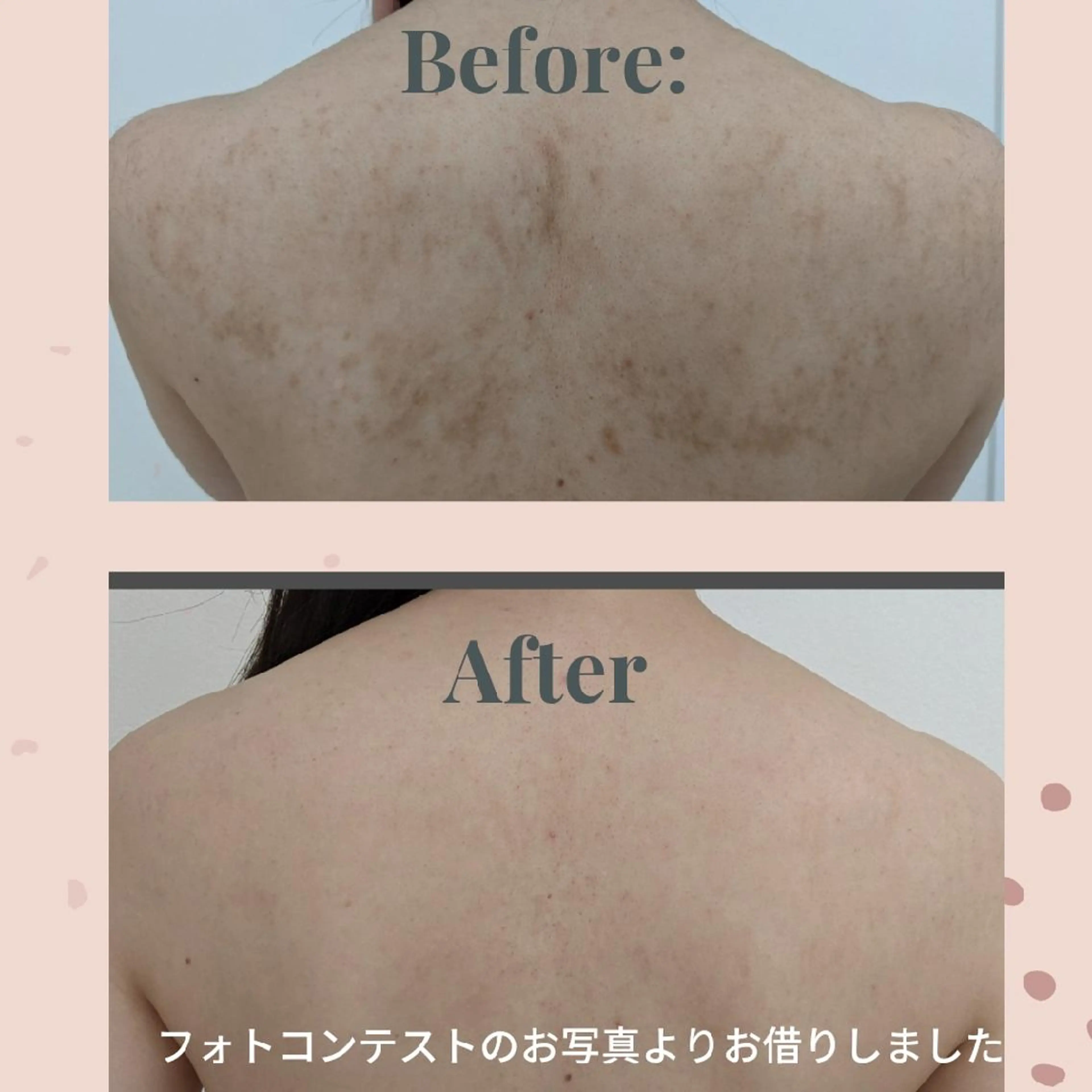 エステ Cantik Cantik チャンティチャンティ所属・高橋 志保のエステ・リラクイメージ