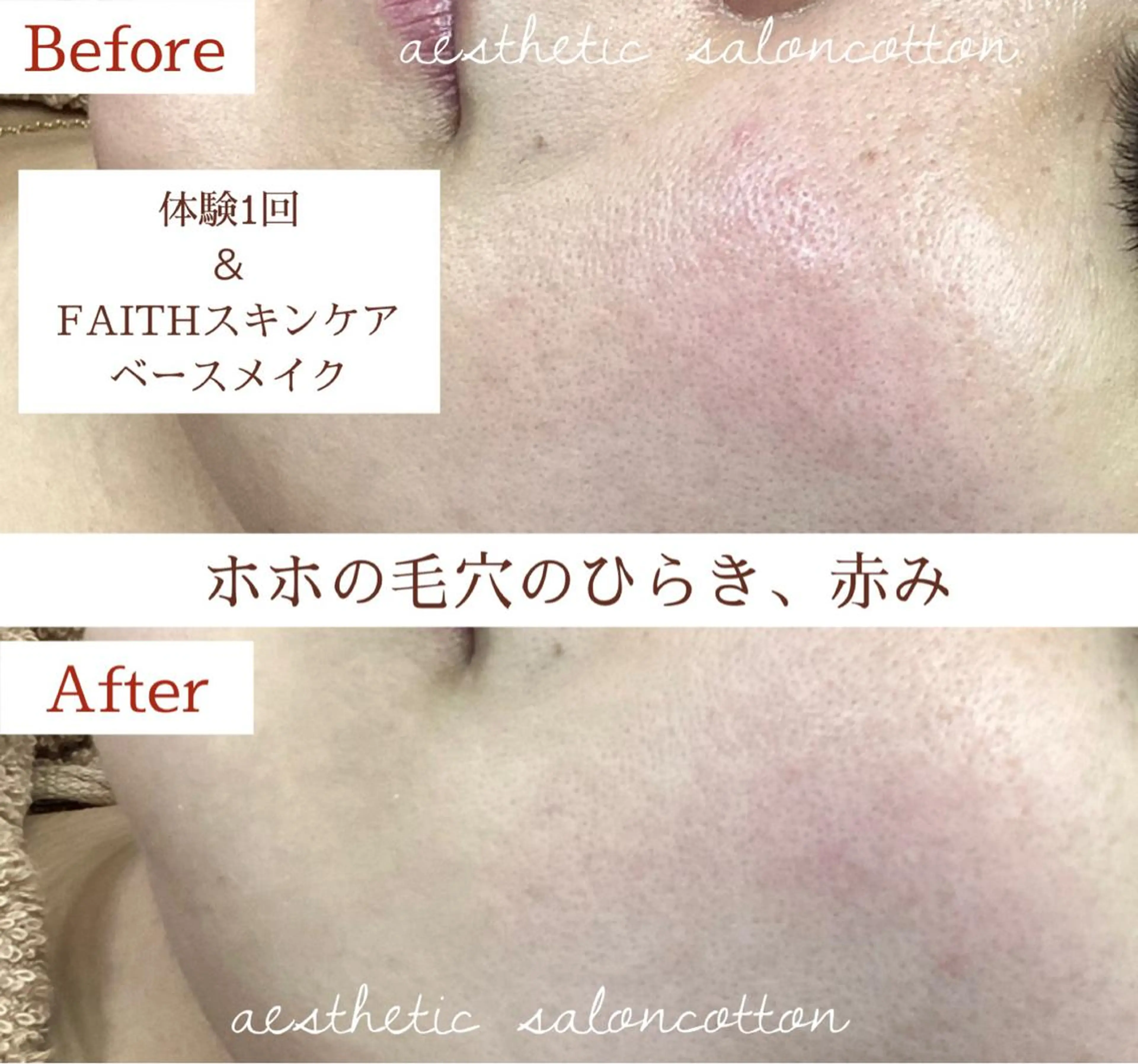 都度払い 肌質改善専門サロンのエステ・リラクイメージ