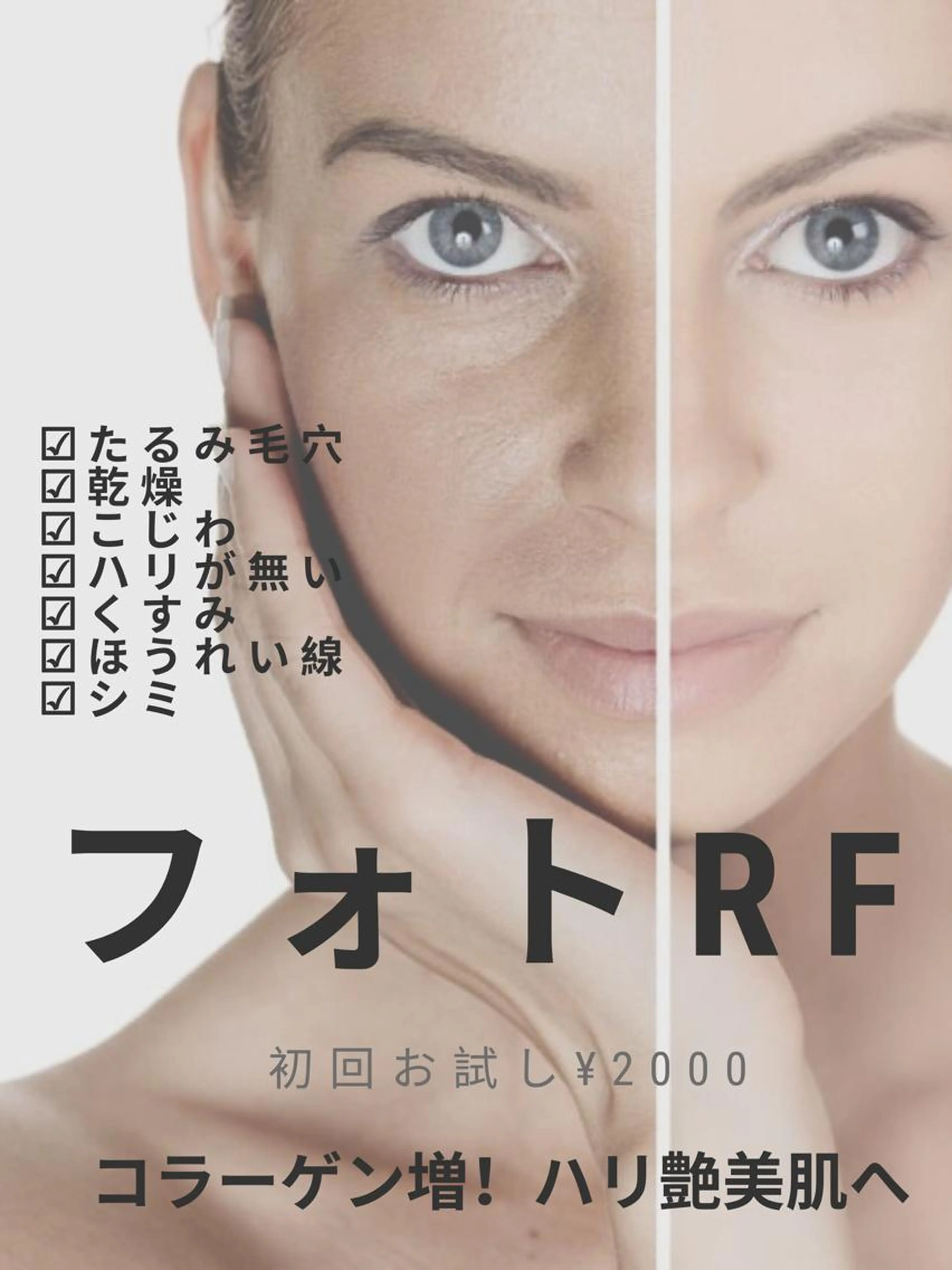 【新規】Lady【フォトRF】エイジレスなお肌を手に入れましょう♡♡コラーゲン増やして目指せ！張り艶美肌☆回数：1回の写真