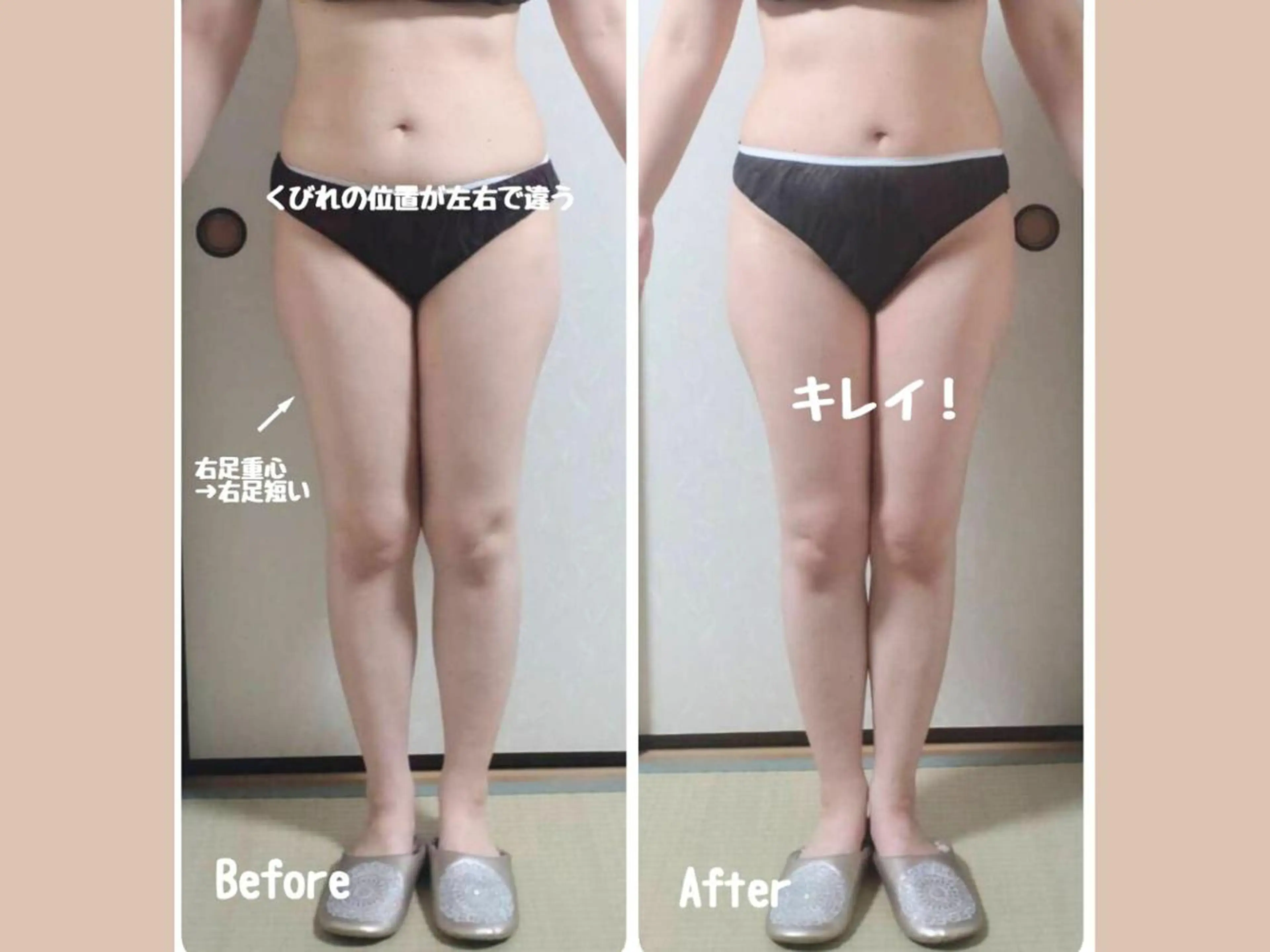 その他 痩身&小顔矯正専門店 Re:Livesのエステ・リラクイメージ