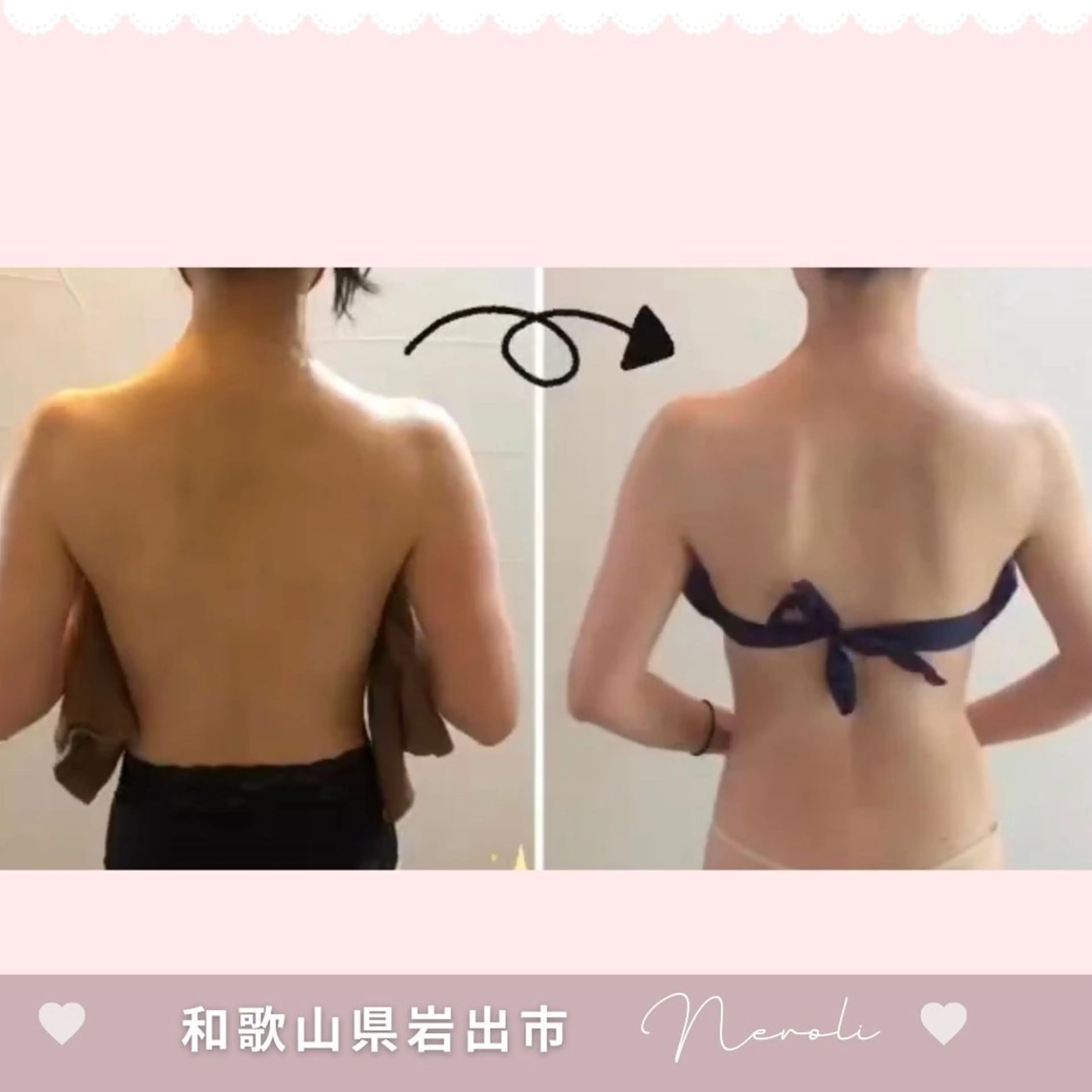 エステ 温活beautyサロンNeroli所属・切らない脂肪吸引🔥 Neroliまりこのエステ・リラクイメージ