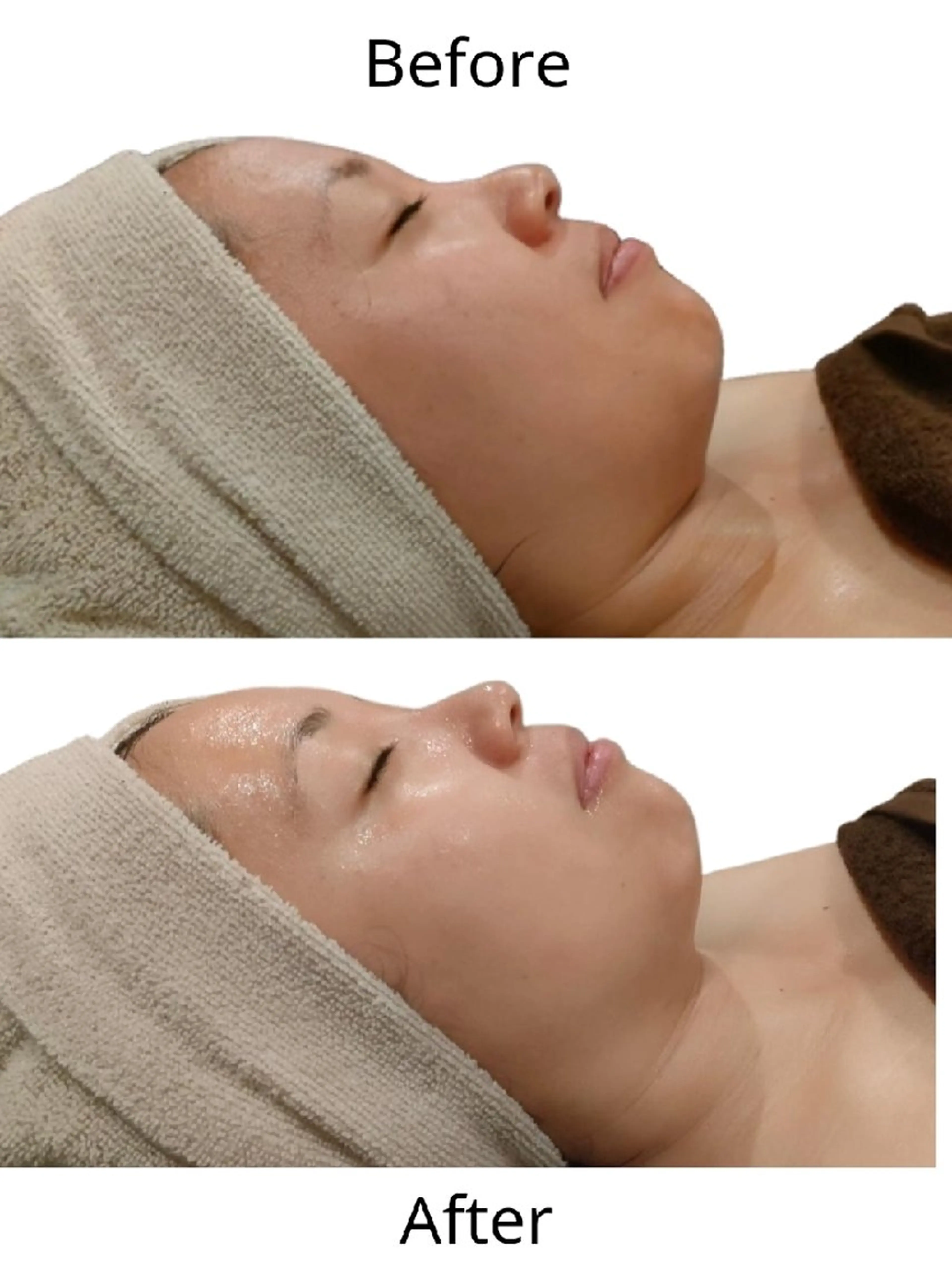 美肌脱毛＆小顔・フェ イシャル【SONA】のエステ・リラクイメージ