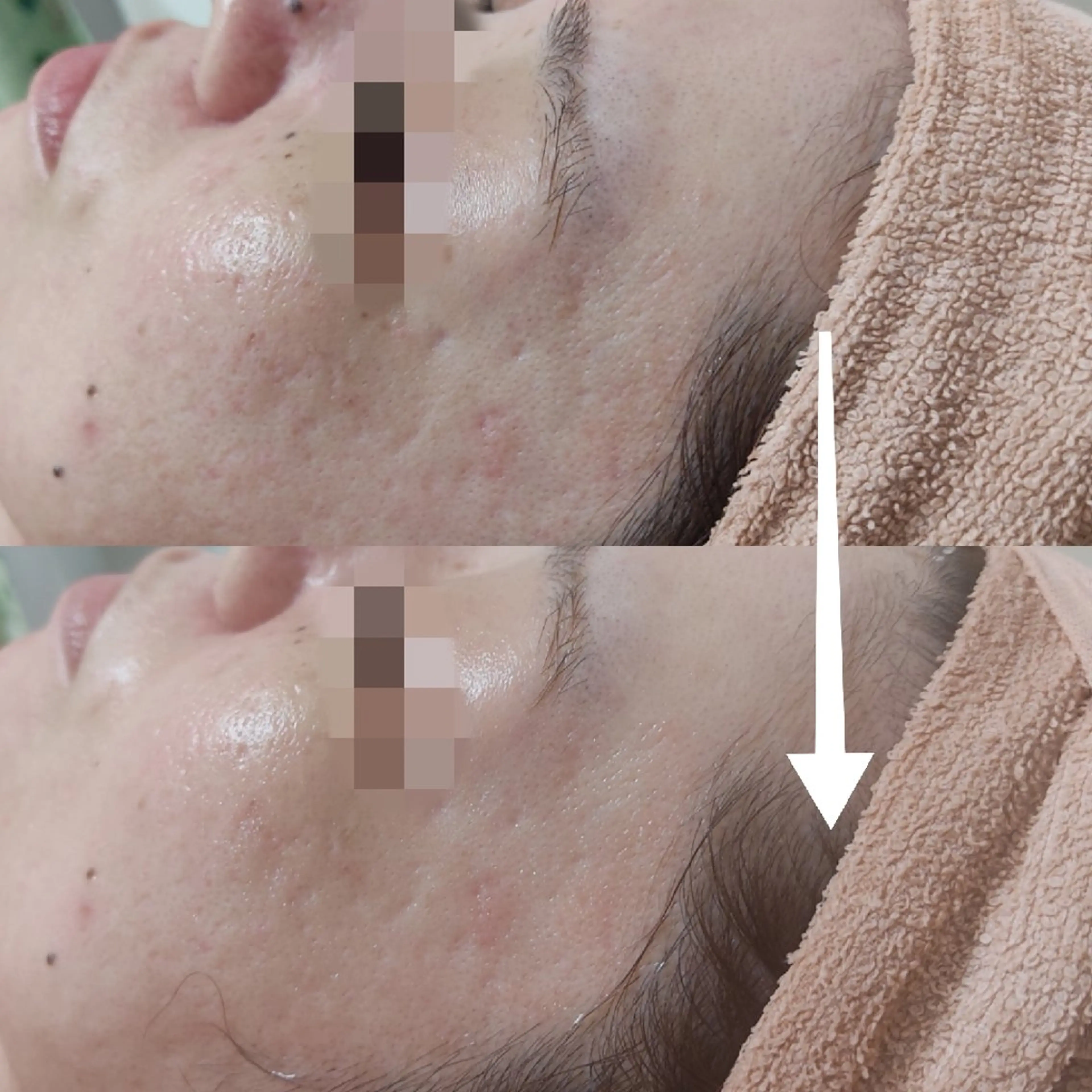 エステ リラク 山野愛子どろんこ美容〜Lough〜所属・山野愛子どろんこ美容 Laughのその他イメージ