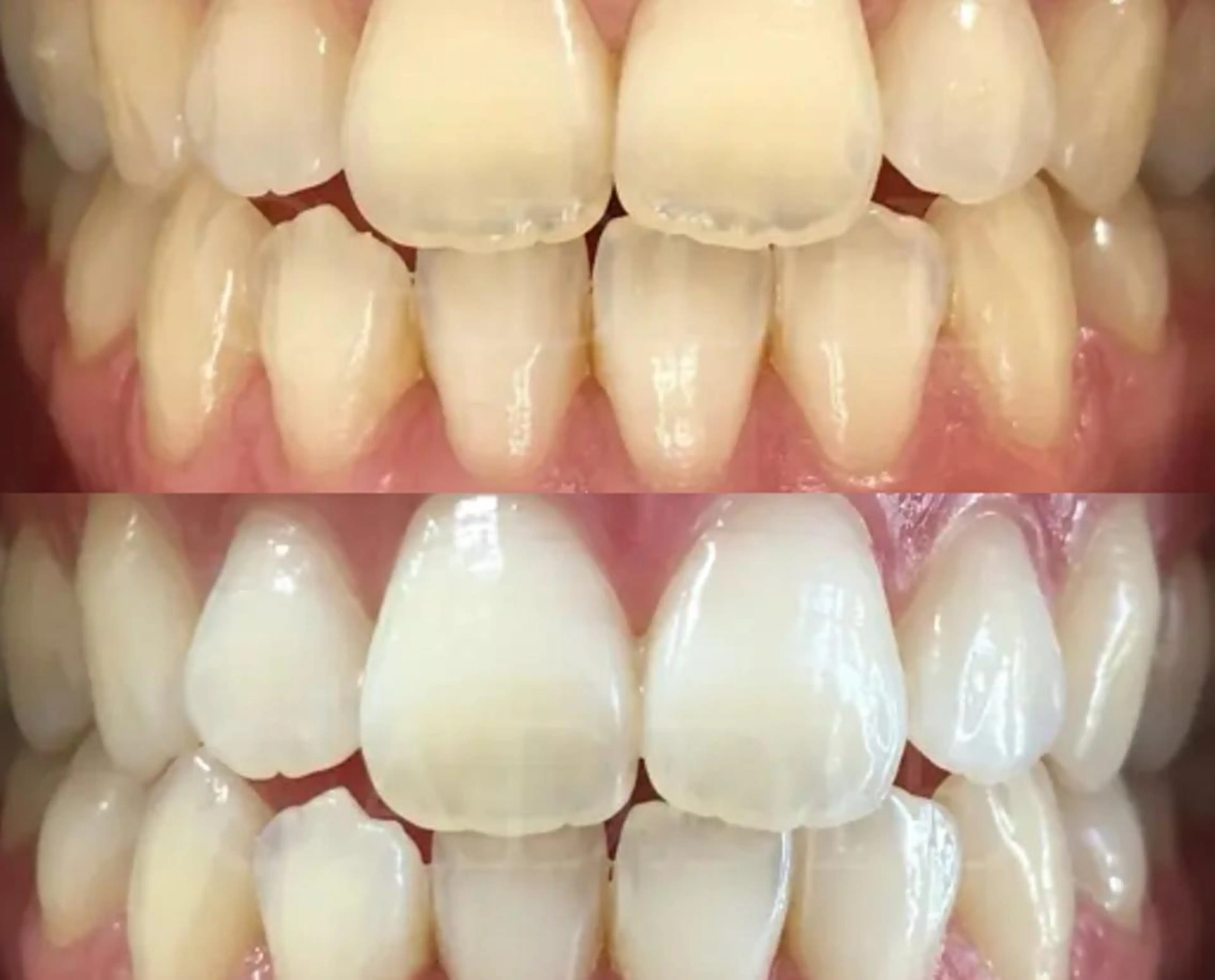 その他 ライトケアサロン 表参道店① 佐々木のその他イメージ