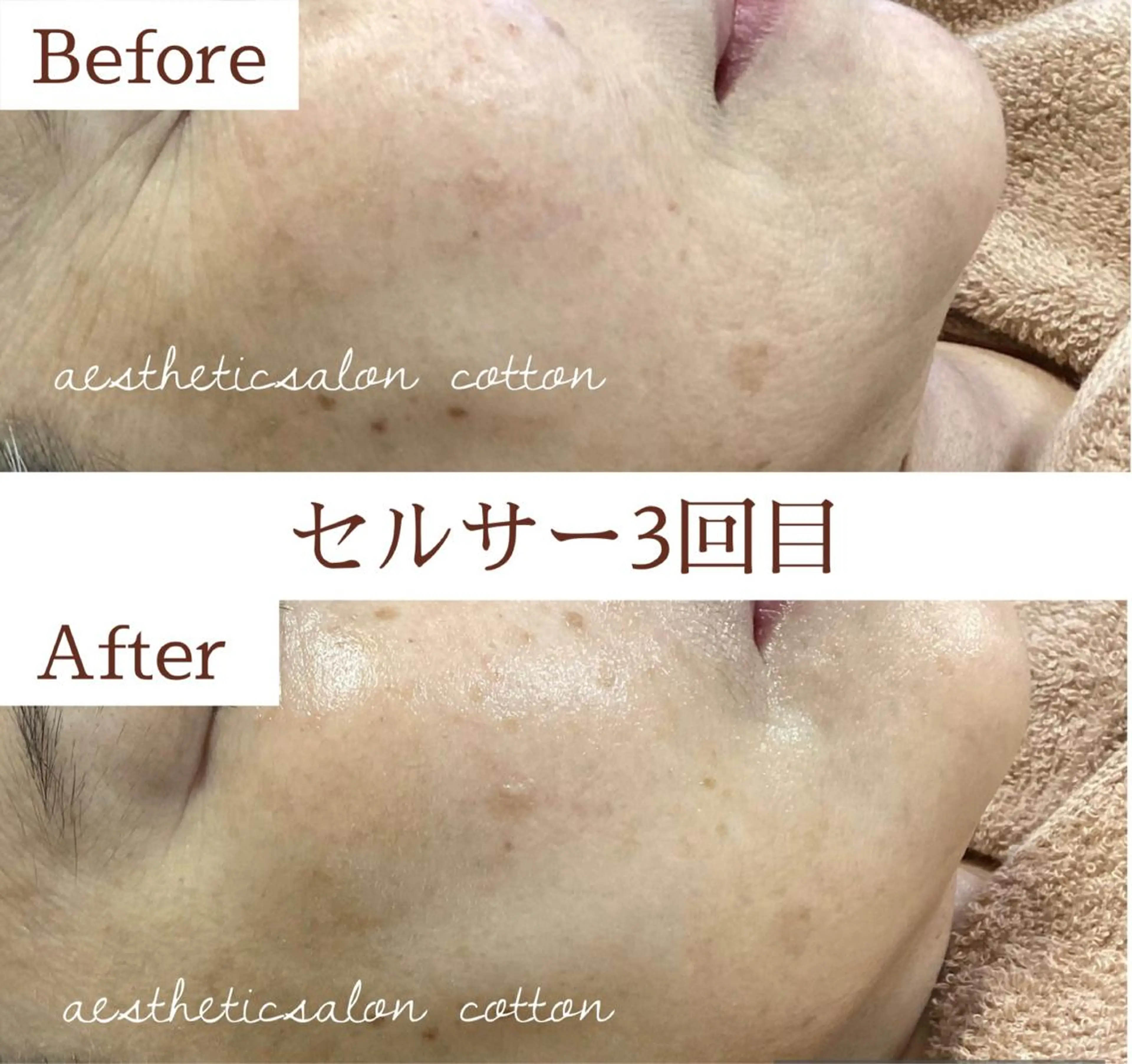 都度払い 肌質改善専門サロンのエステ・リラクイメージ