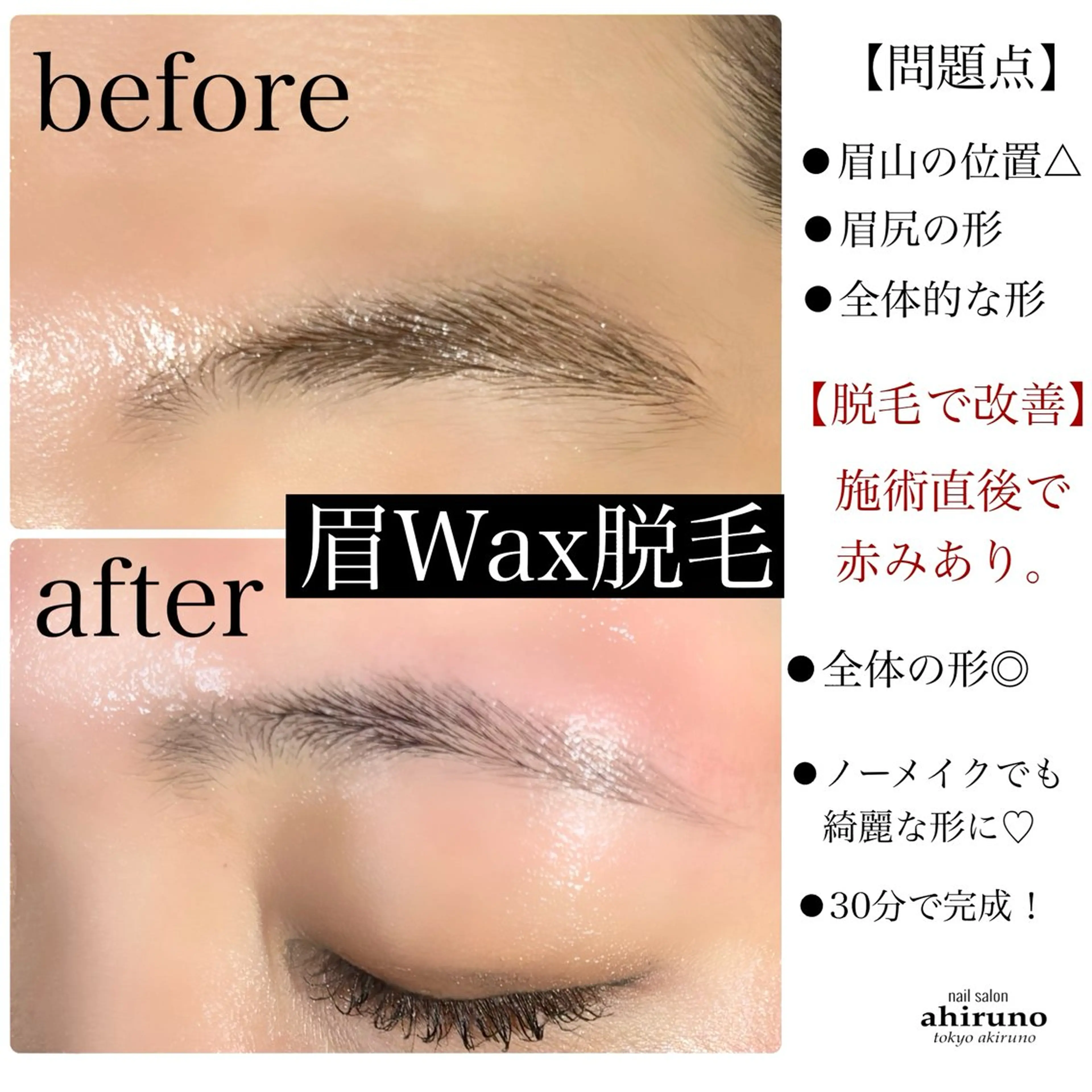 アイブロウ 眉毛ワックス脱毛 ワックス脱毛 ａｈｉｒｕｎｏ ✿ ｙｕiのネイルデザイン