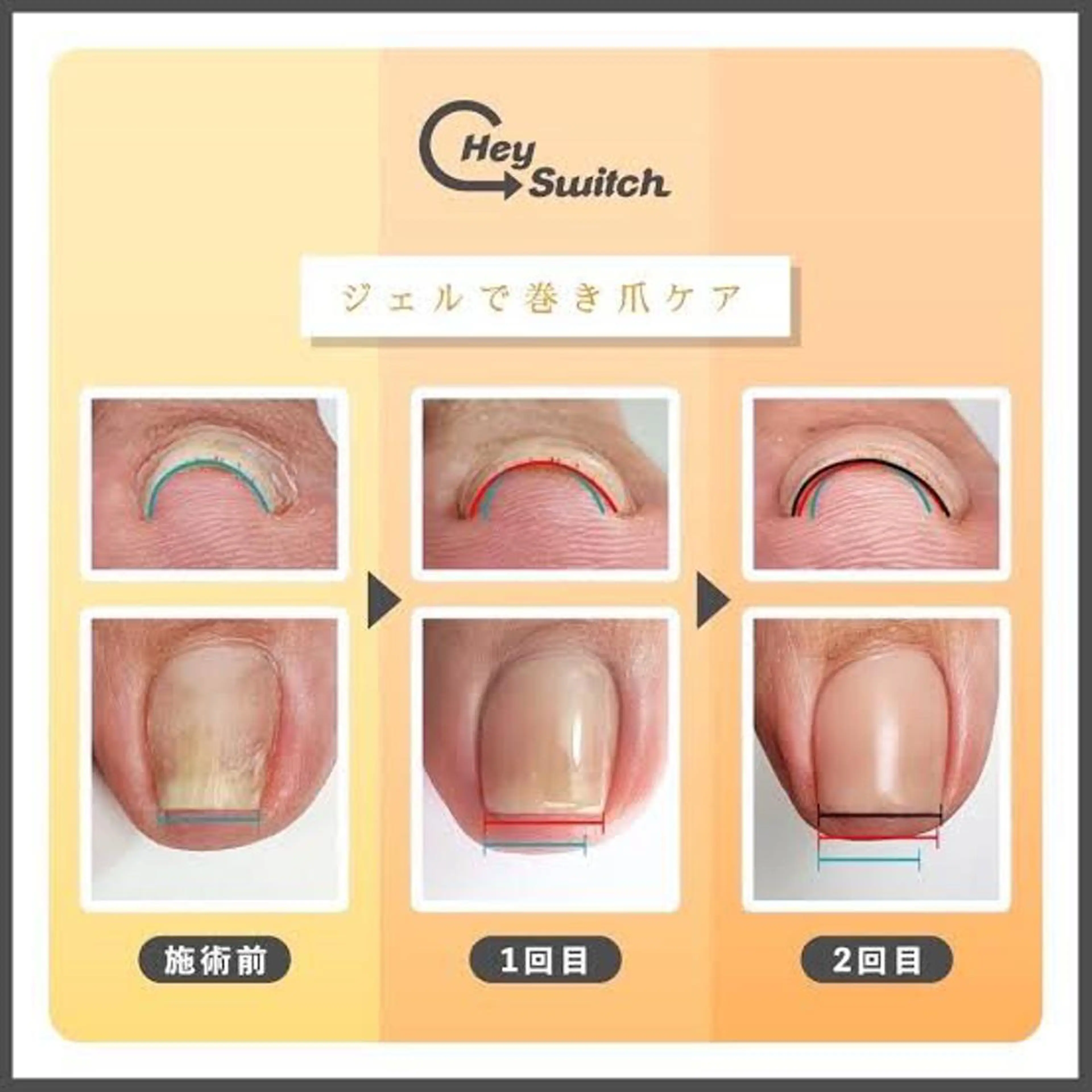 ショート ネイル Collection Nailsaronのネイルデザイン