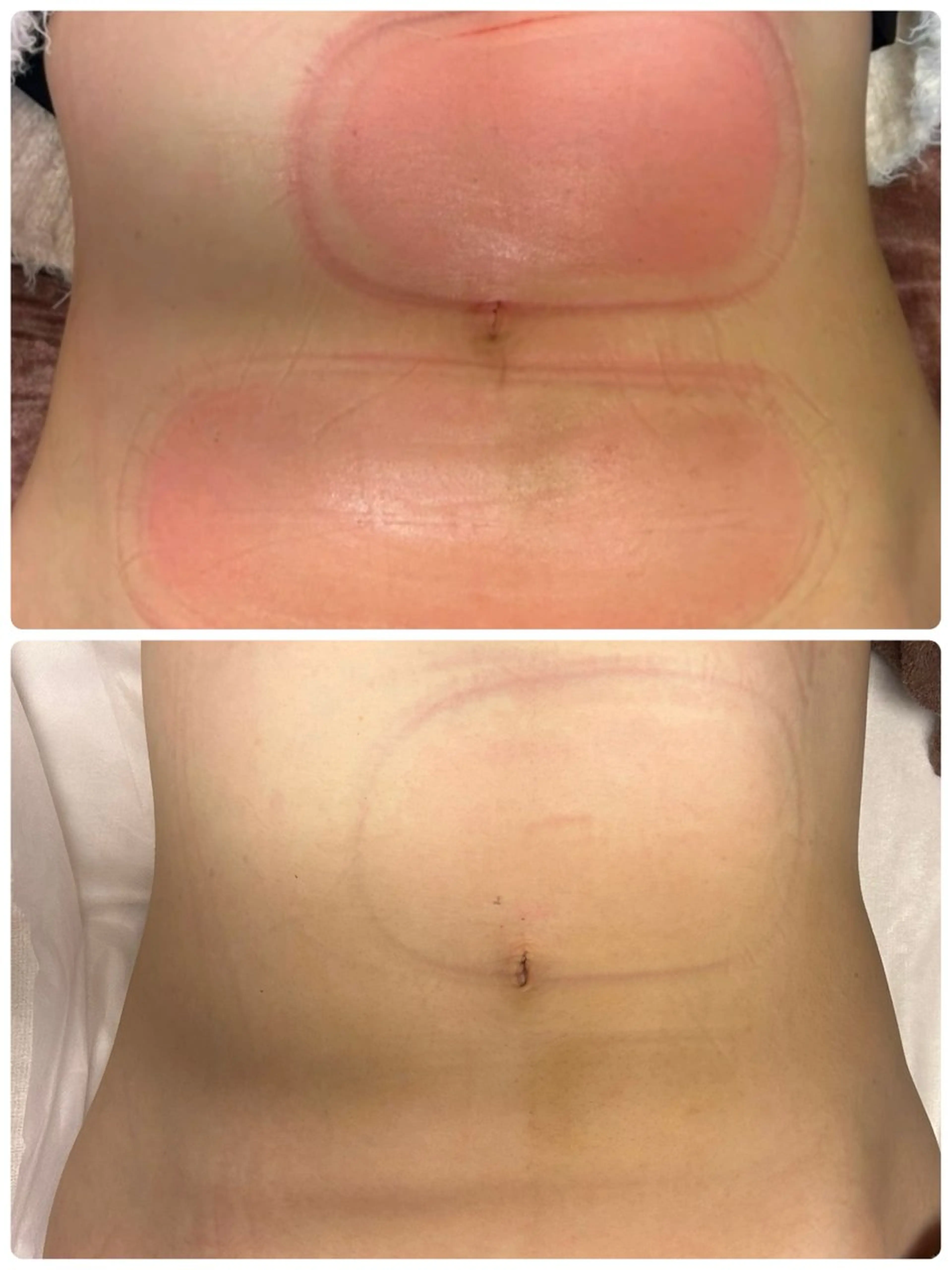 エステ リフュージュ所属・リフュージュ隠れ家 八王子の眉毛・アイブロウイメージ