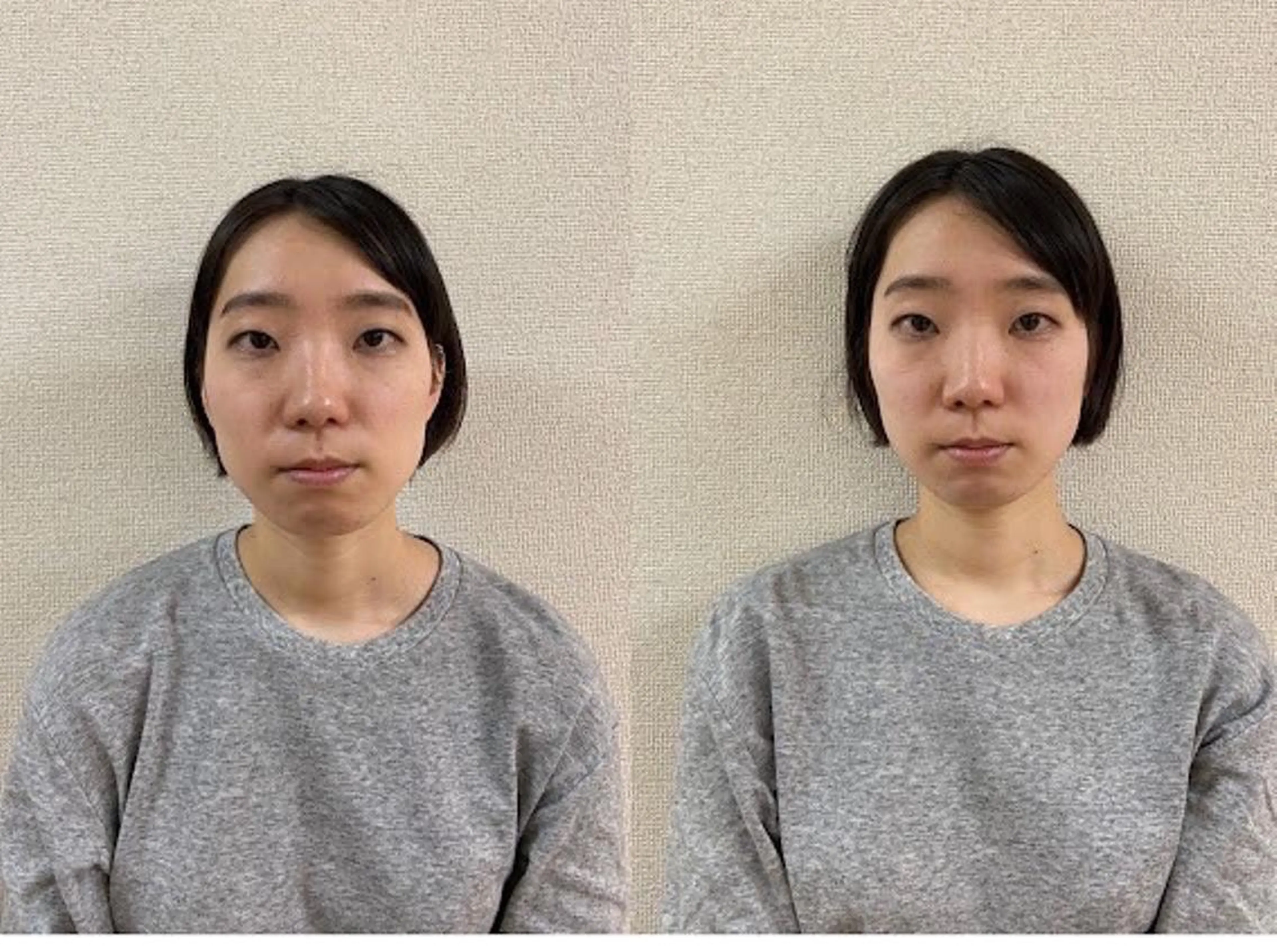 美容整体　小顔矯正 プラスフィール飯野のエステ・リラクイメージ