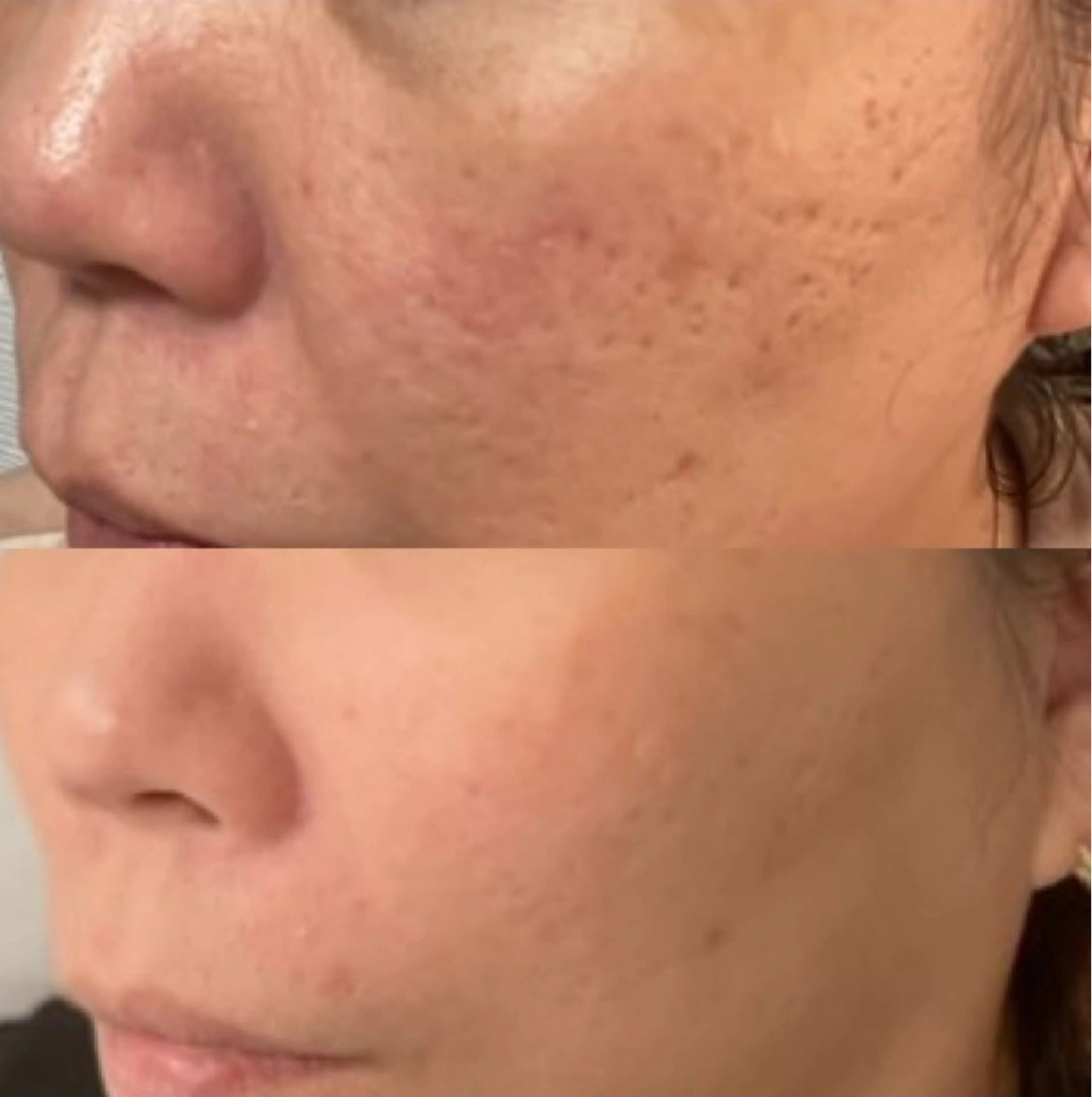 メンズ Blooming所属・LOUISE. ／肌質・頭皮のエステ・リラクイメージ