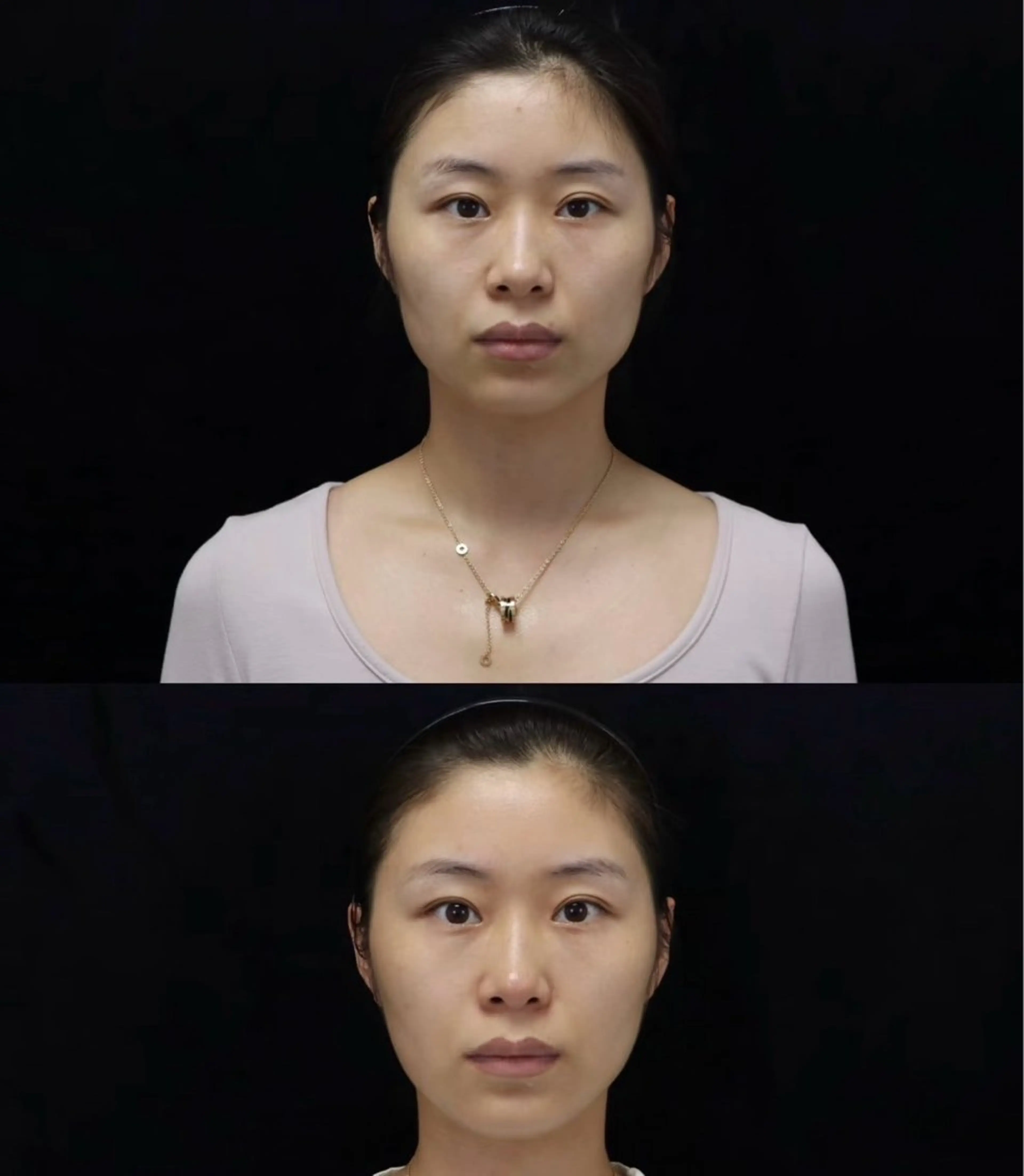 マツエク・マツパ エステ リラク 愛維美水光美肌専門店所属・愛維美水光美肌専門店 メンズレディースokのエステ・リラクイメージ