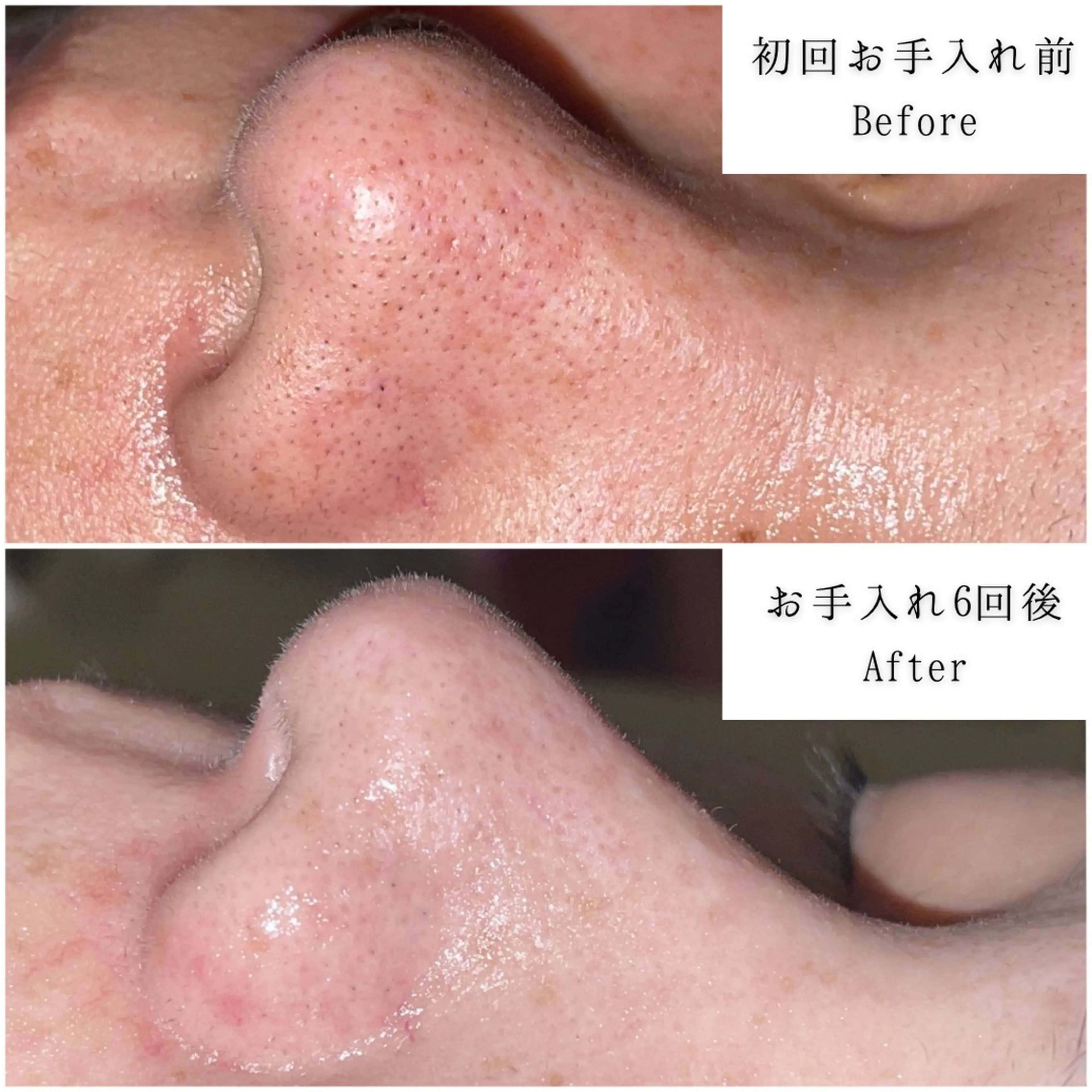 SELF  BEAUTY gracia浦添店所属・gracia 浦添店のその他イメージ