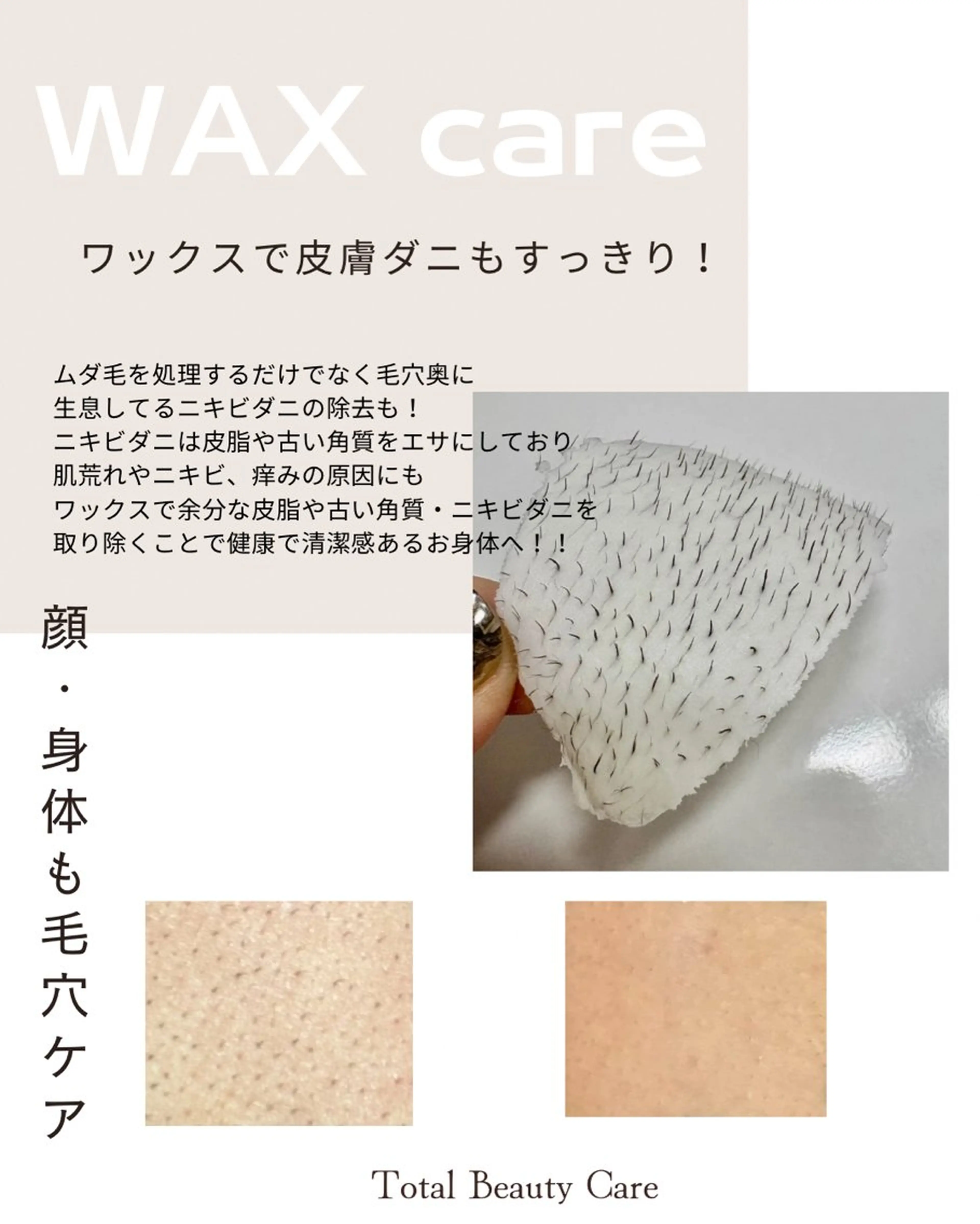 脱毛 ダイエット／脱毛 美顔／フォト／ハーブのその他イメージ